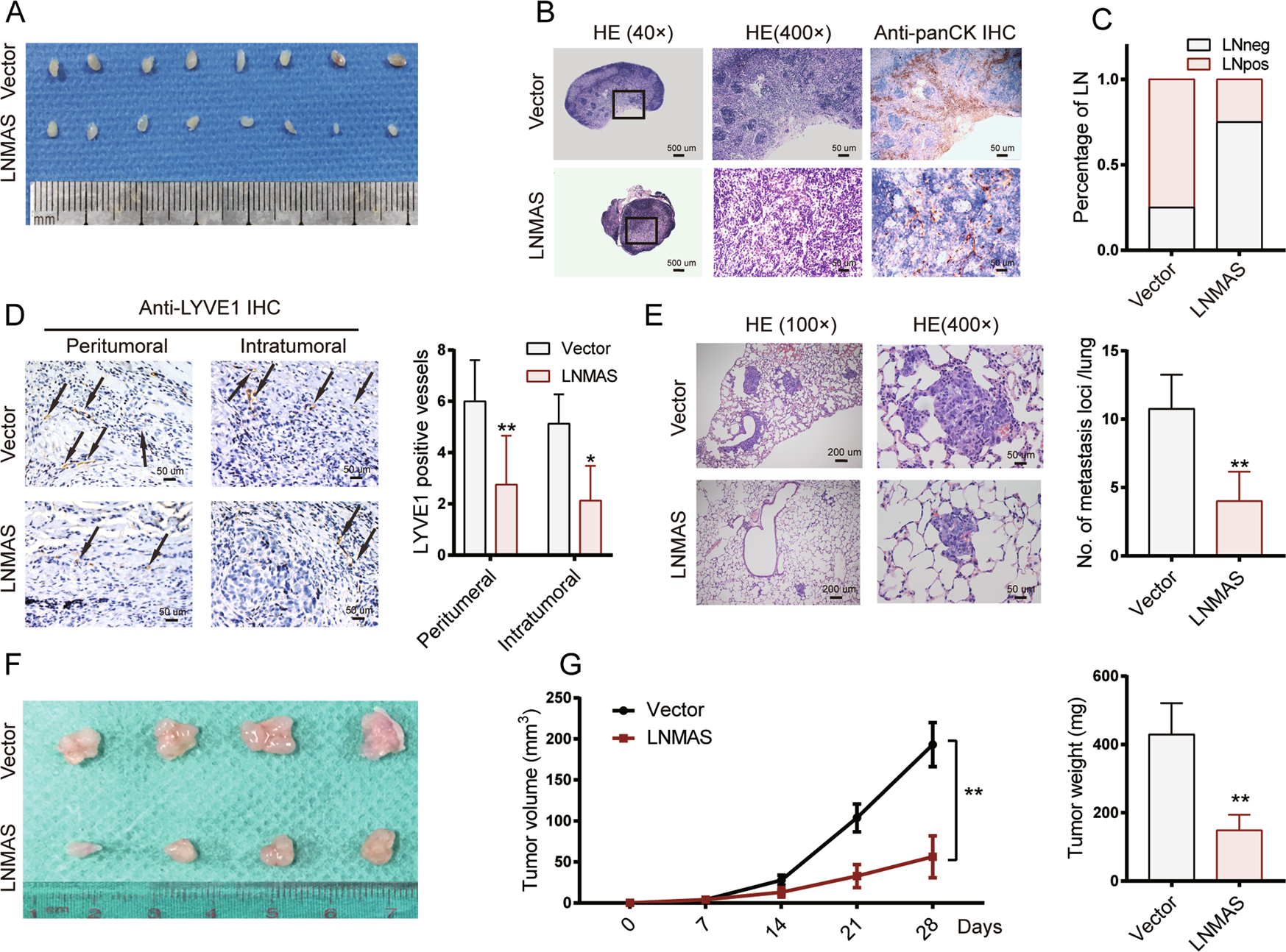 Fig. 3: LNMAS inhibits cervical cancer cells metastasis and tumor growth in vivo.