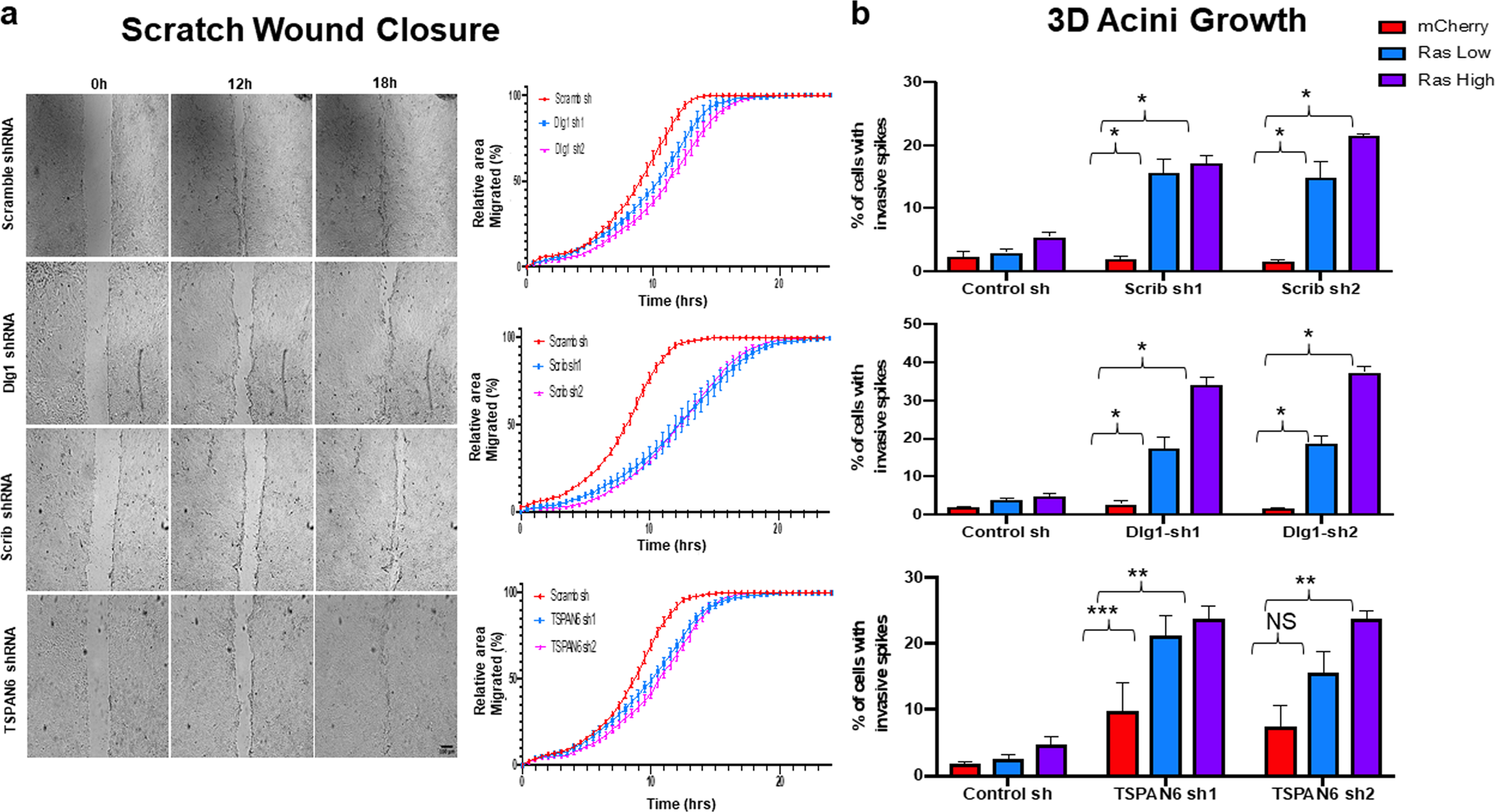Fig. 1: TSPAN6 controls epithelial cell migration and cooperates with H-RASV12 to induce cell invasion in normal human mammary epithelial cells.