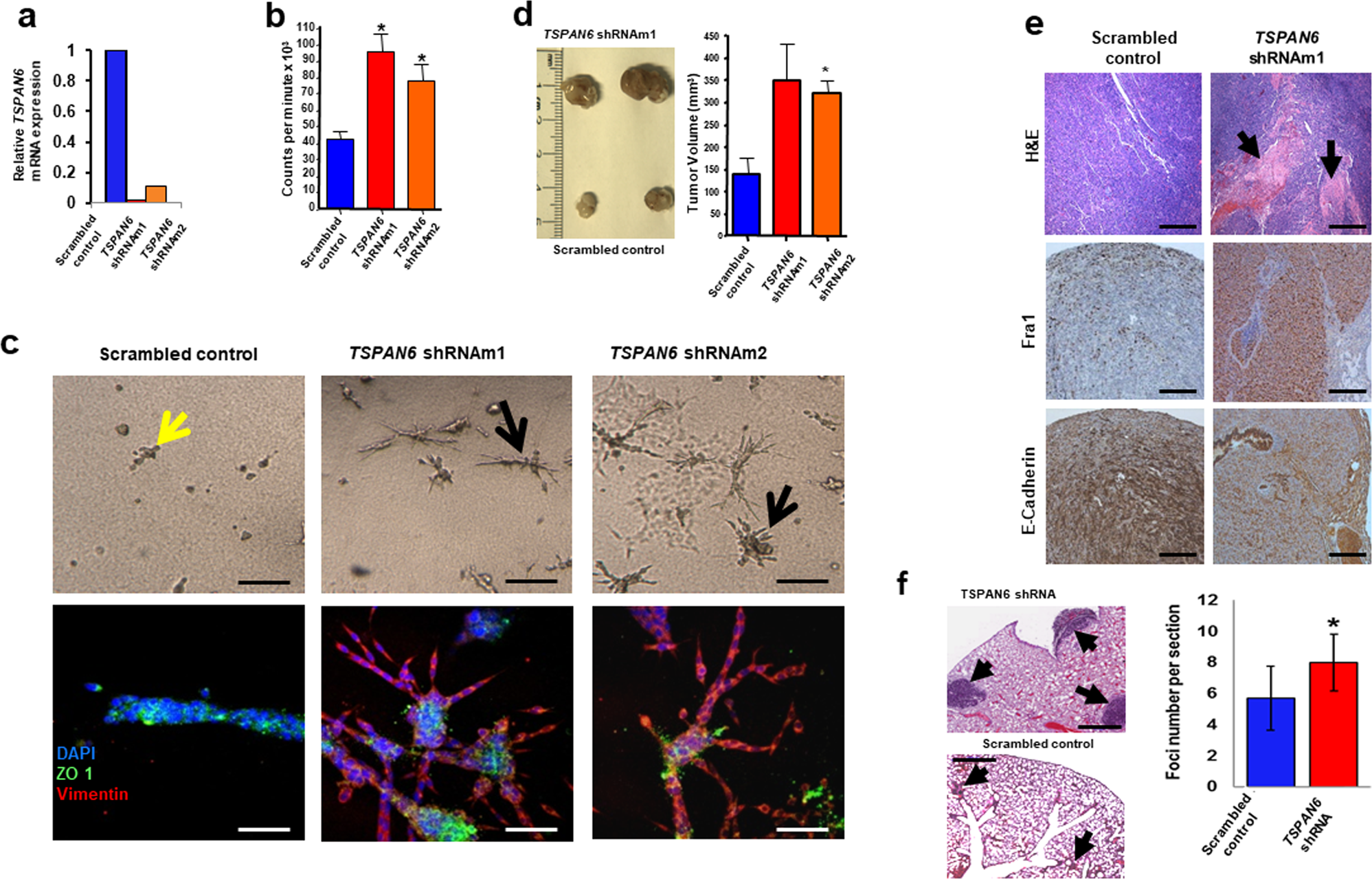 Fig. 2: Tspan6 knockdown in EpRas mouse mammary epithelial cells affects cell polarity, proliferation, and invasion.