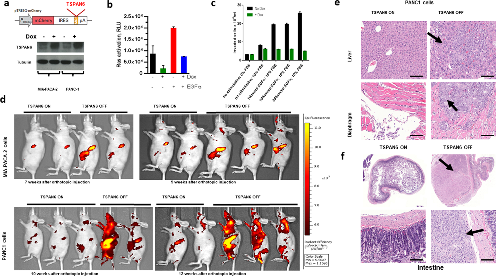 Fig. 3: TSPAN6 inhibits growth and metastasis of activating RAS mutant human epithelial tumor cells.