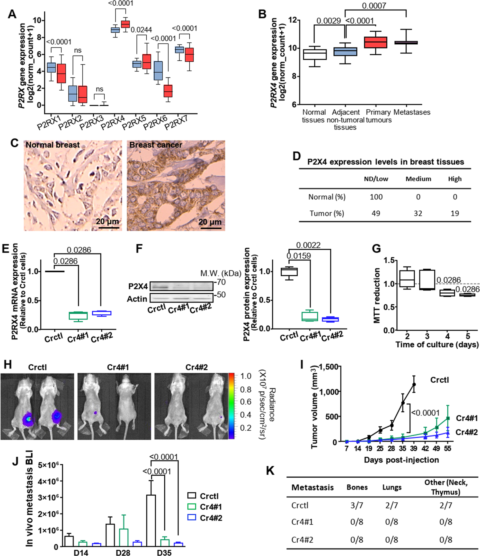 P2x4 receptor promotes mammary cancer progression by sustaining autophagy  and associated mesenchymal transition | Oncogene