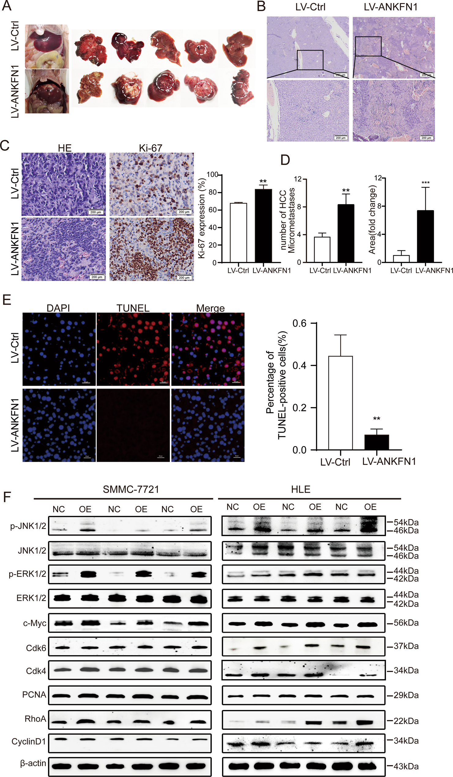 Fig. 6: Overexpression of ANKFN1 promotes HCC migration and metastasis in vivo.