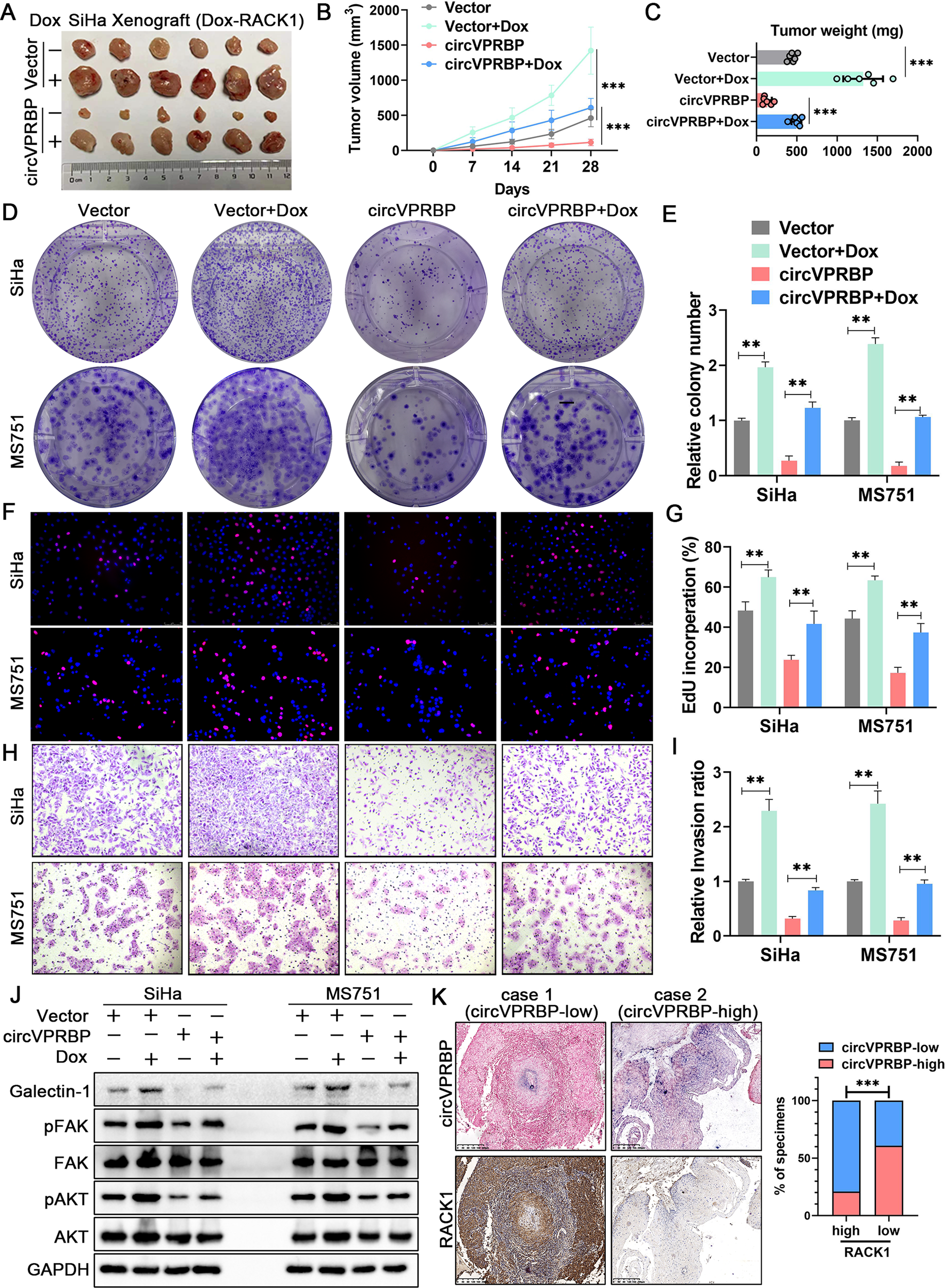 Fig. 8: Blocking RACK1 degradation is crucial for tumor growth in CCa.
