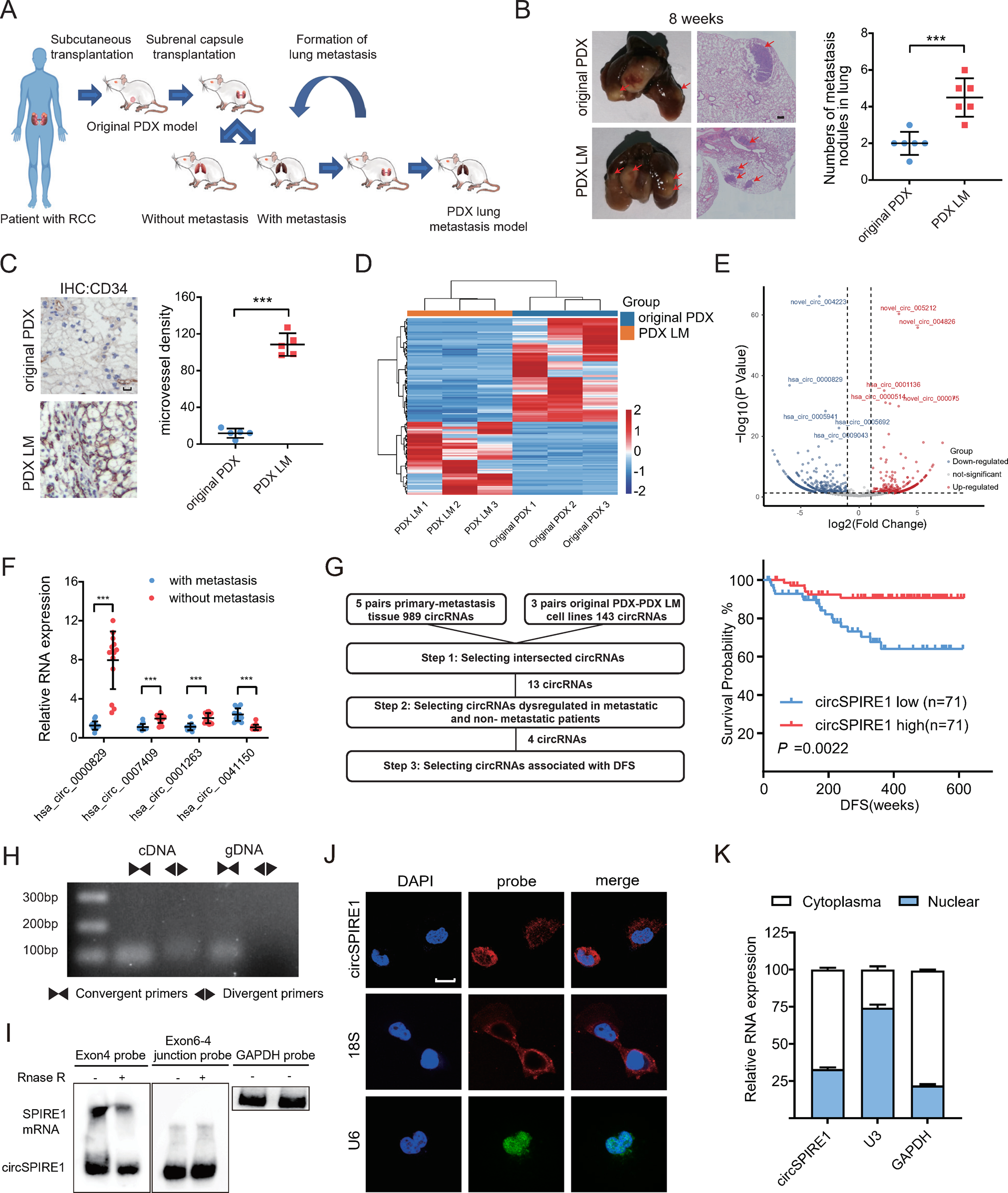 Fig. 1: Downregulation and characterization of circSPIRE1 in metastatic RCC.
