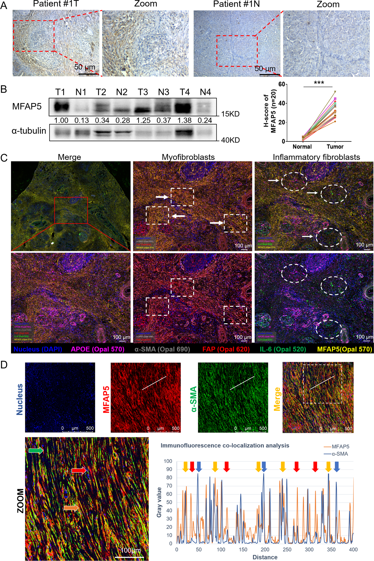 LS Models nude fap Targeting MFAP5 in cancer-associated fibroblasts sensitizes pancreatic  cancer to PD-L1-based immunochemotherapy via remodeling the matrix |  Oncogene