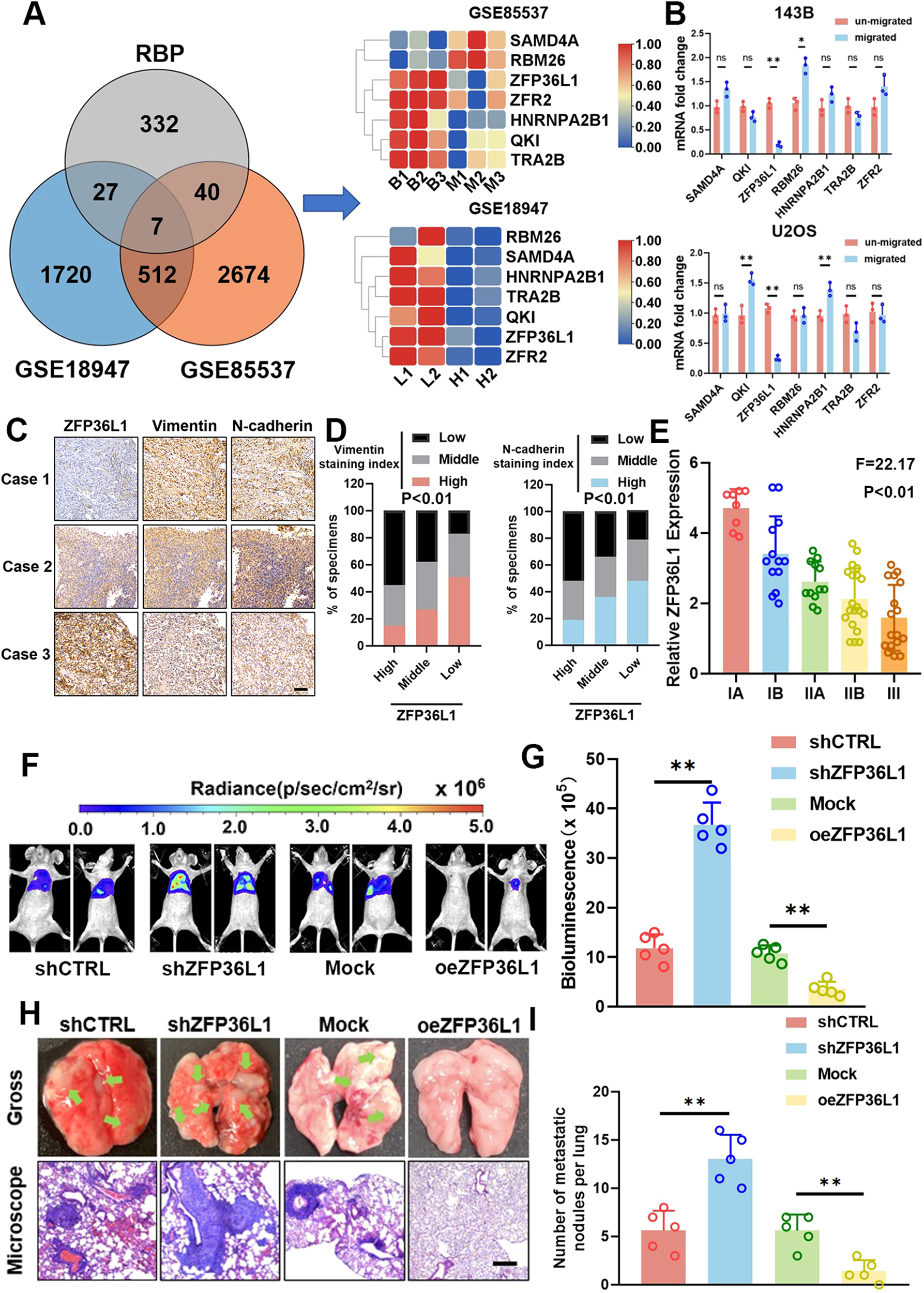 Fig. 1: Downregulation of ZFP36L1 is correlated with the malignant progression of osteosarcoma.