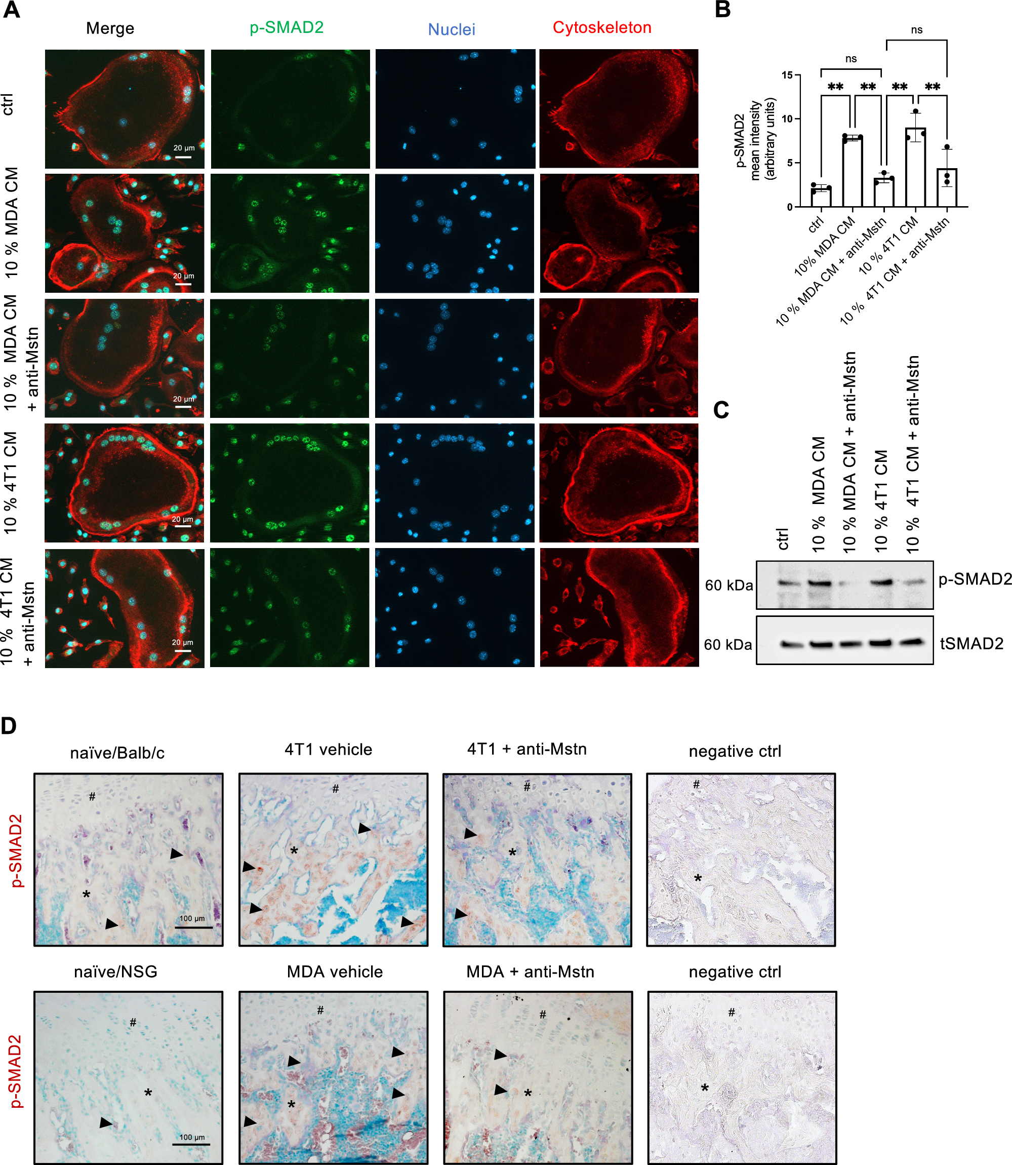 Fig. 8: Anti-Mstn treatment reduces tumor-cell mediated SMAD2 phosphorylation in osteoclasts.