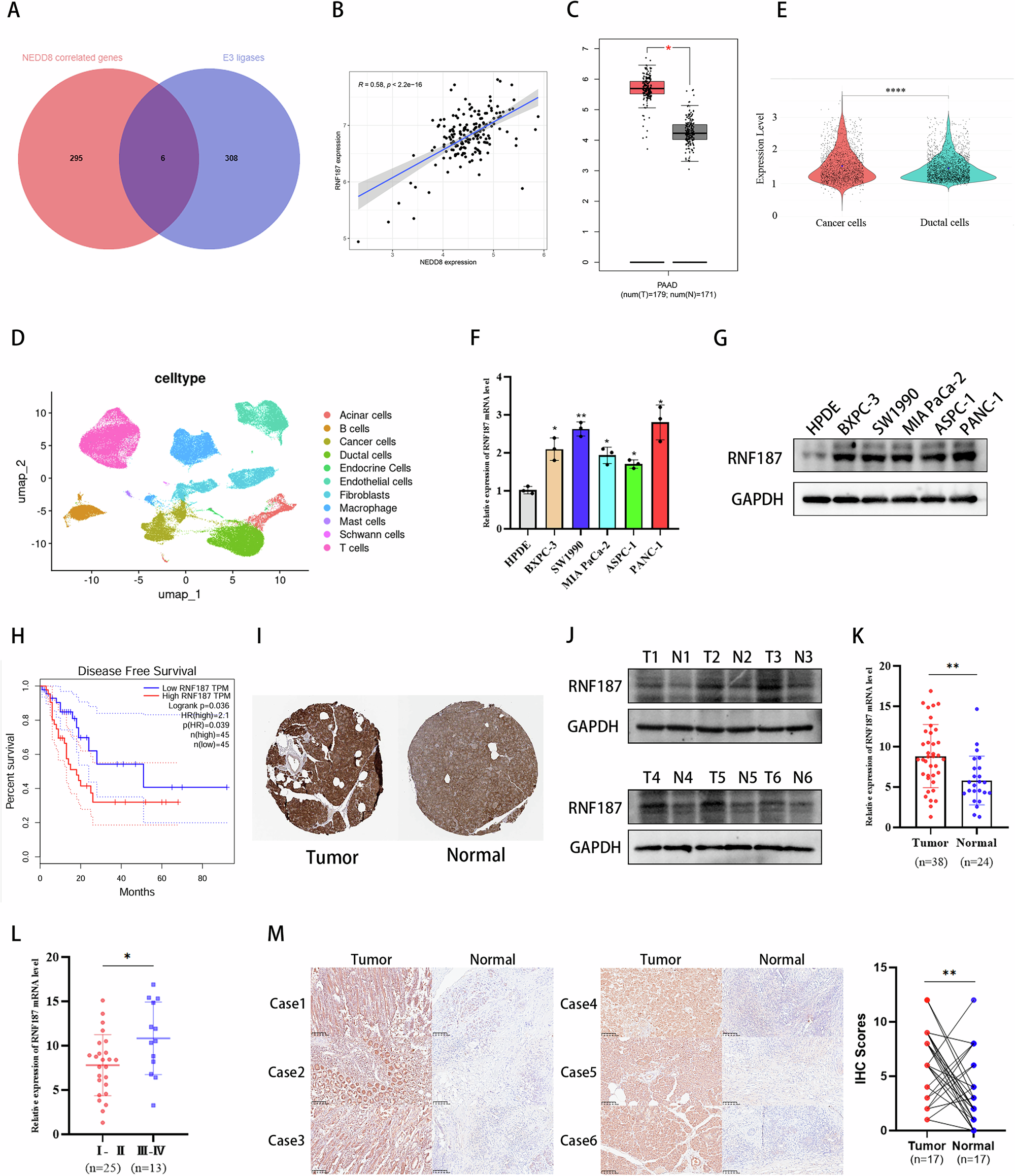 Fig. 1: RNF187 expression is elevated in pancreatic cancer and correlates with NEDD8.