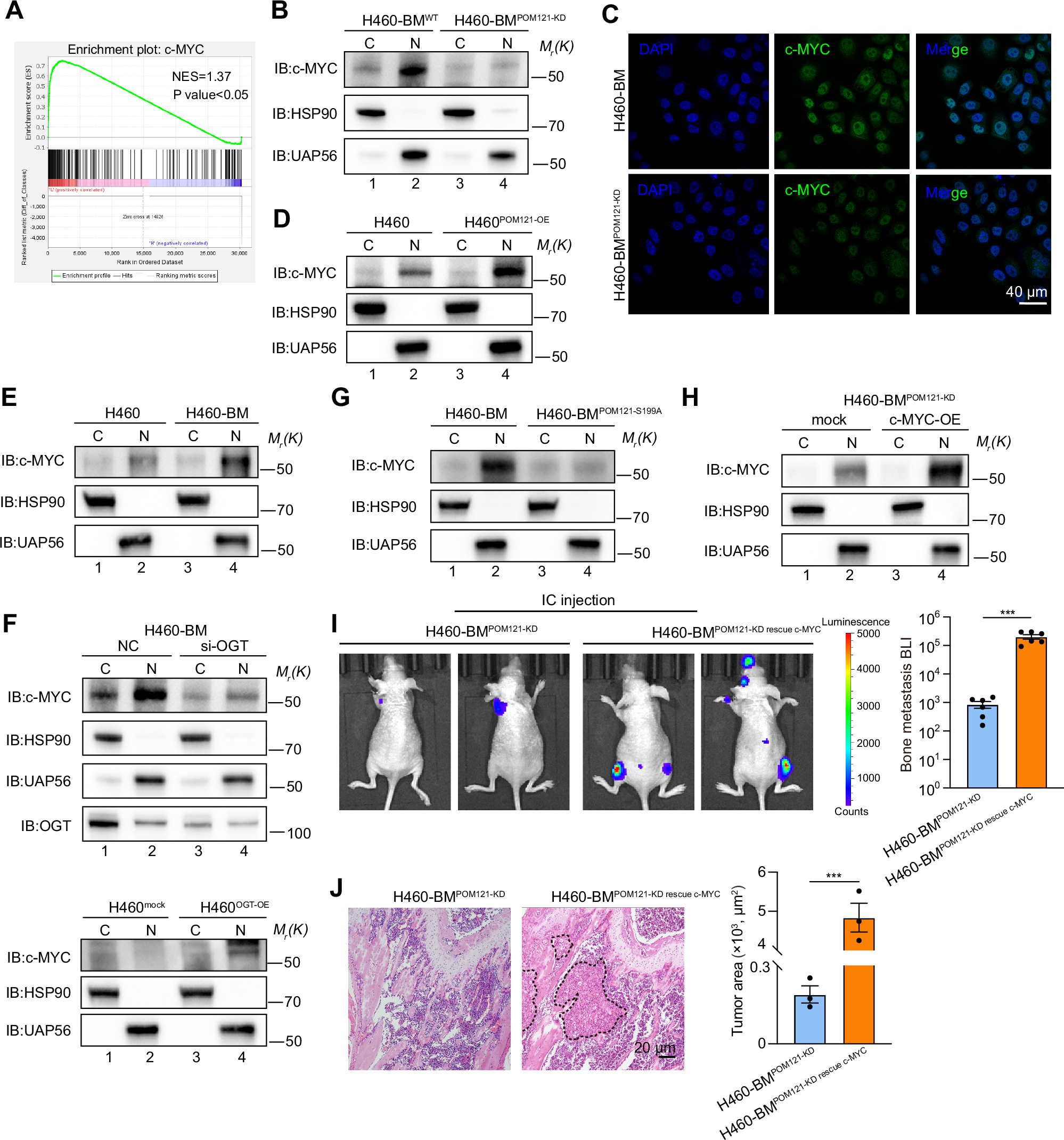 Fig. 4: POM121 promotes c-MYC nuclear translocation to drive bone metastasis.