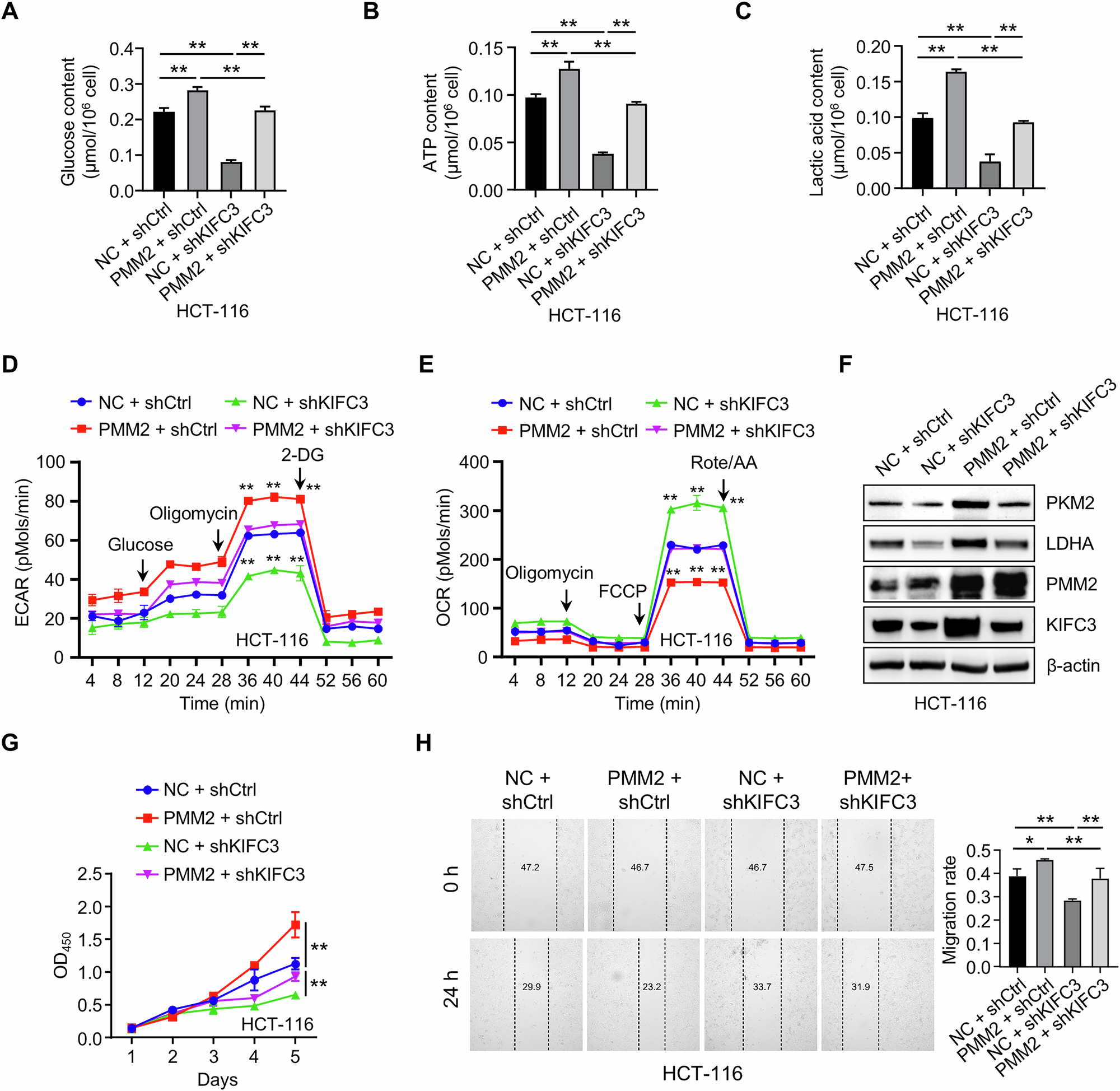 Fig. 6: KIFC3 mediates PMM2-driven glycolysis and CRC progression.