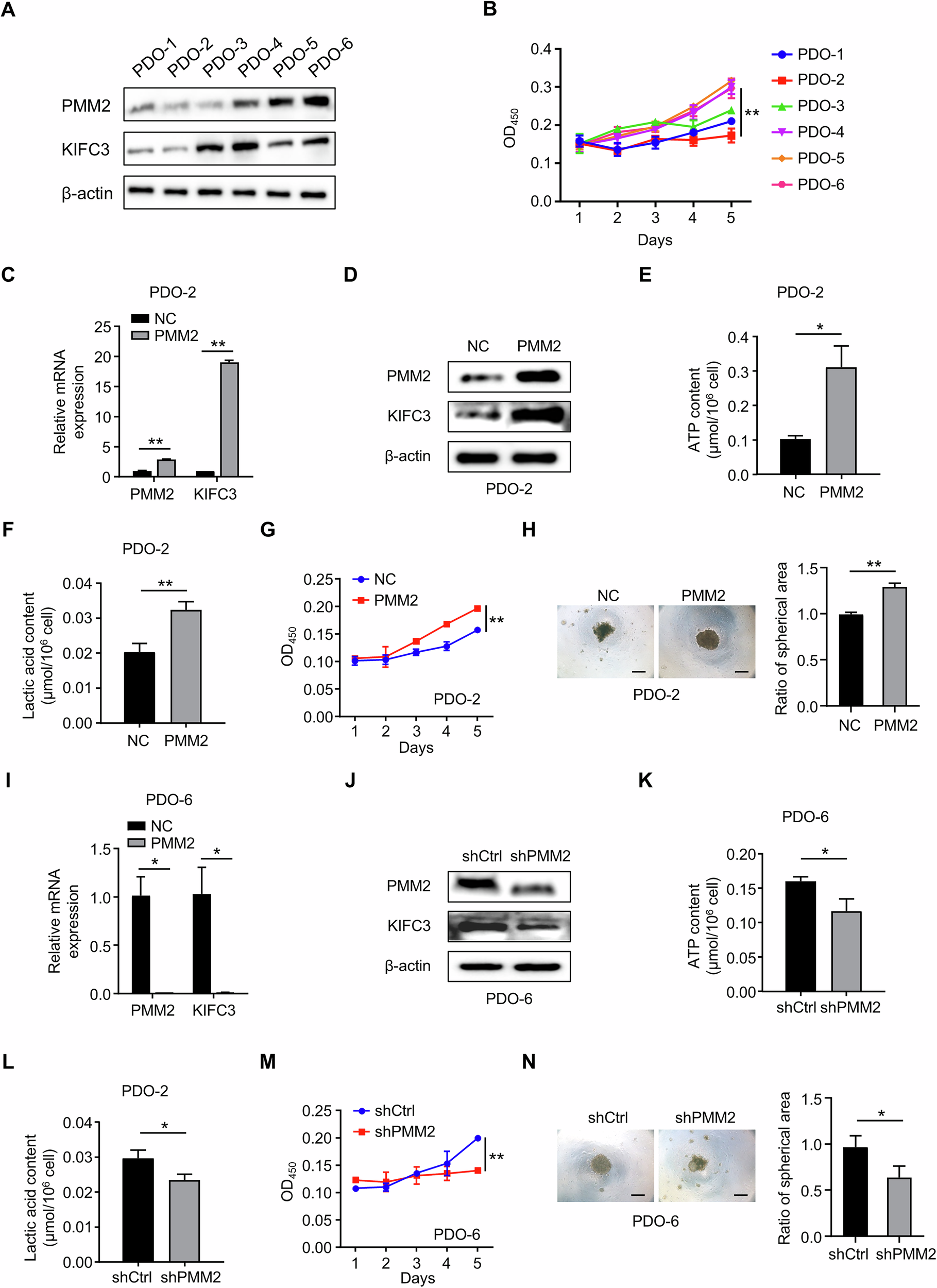 Fig. 8: PMM2 regulates glycolysis and tumorigenicity in CRC PDOs.