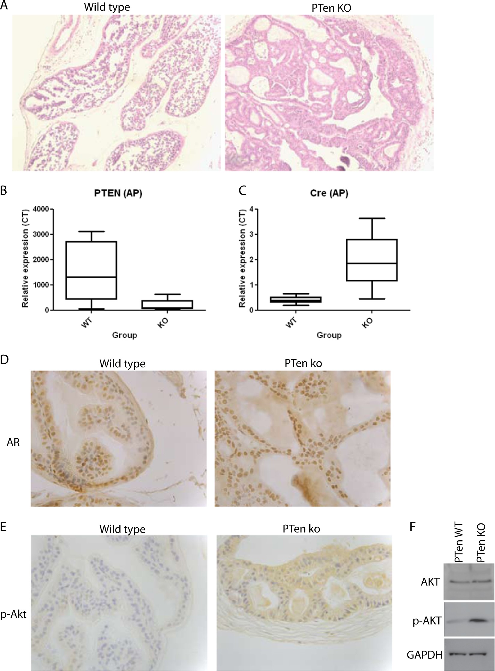 polyaa prostatitis ejszakai agyba vizeles