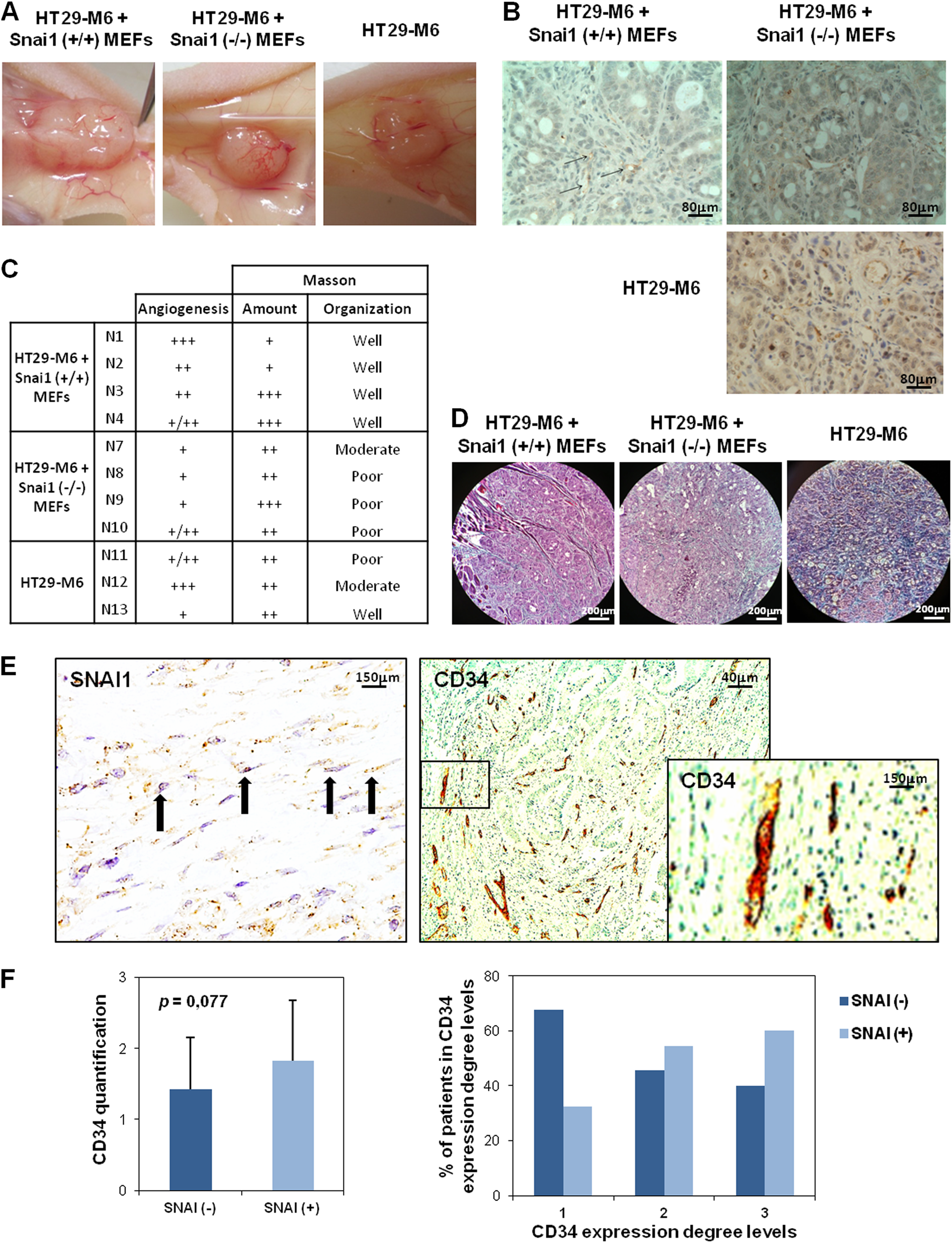 Fig. 6: SNAI1 expression stimulates angiogenesis in xenograft tumor models and is associated with angiogenesis markers in human tumor samples.