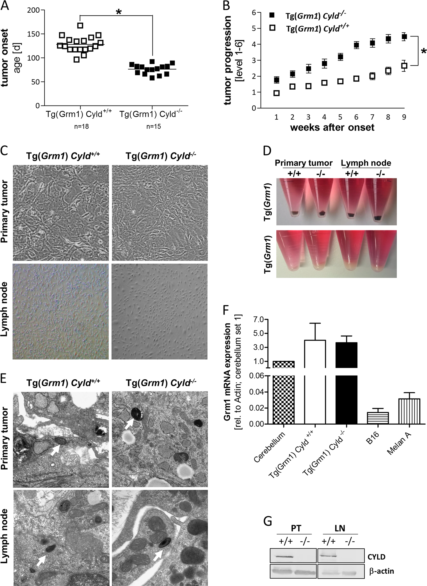 Loss of CYLD accelerates melanoma development and progression in the  Tg(Grm1) melanoma mouse model | Oncogenesis