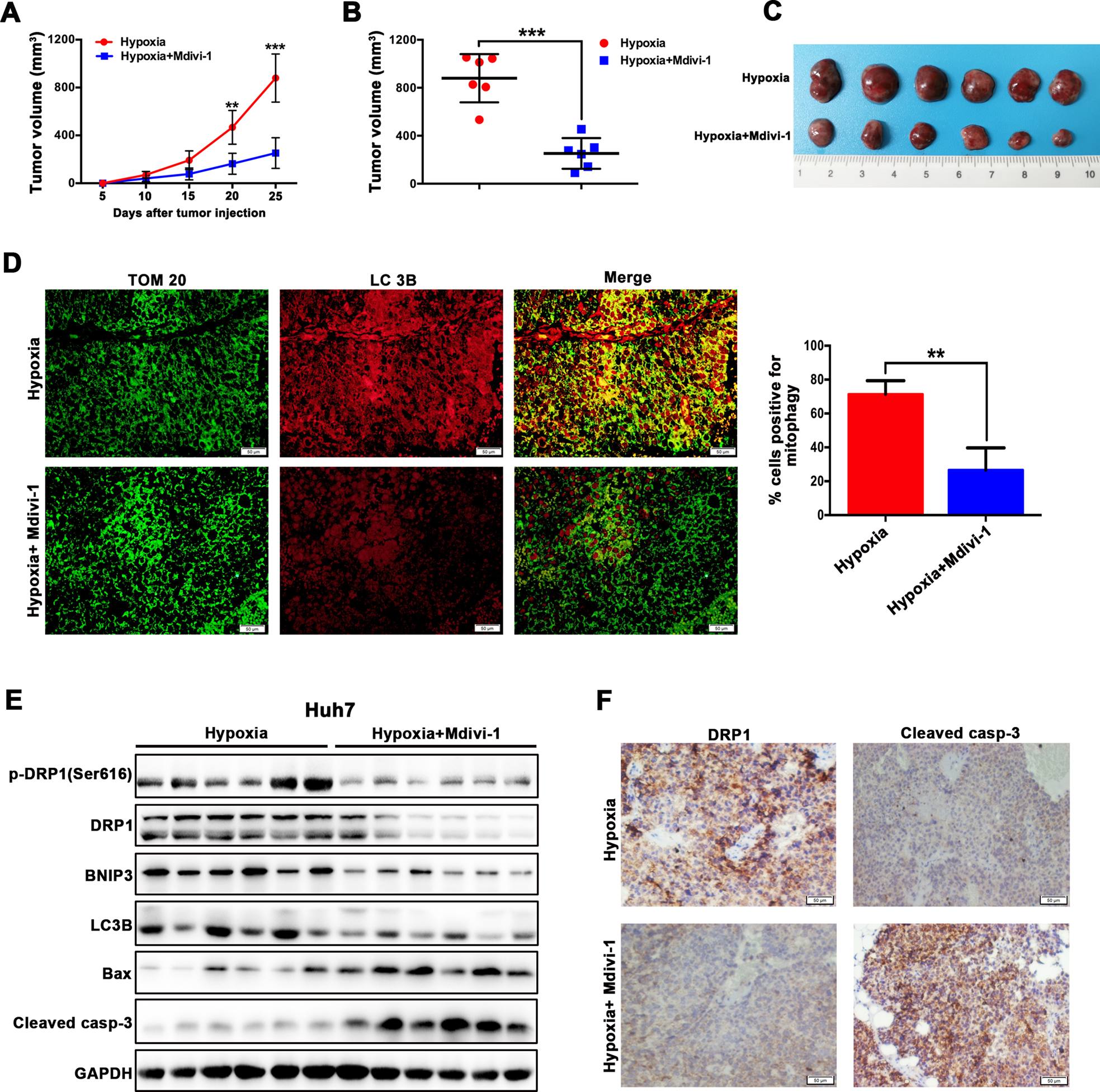 Fig. 4: DRP1 inhibitor Mdivi-1 suppressed the in vivo growth of hypoxia-treated HCC cells.