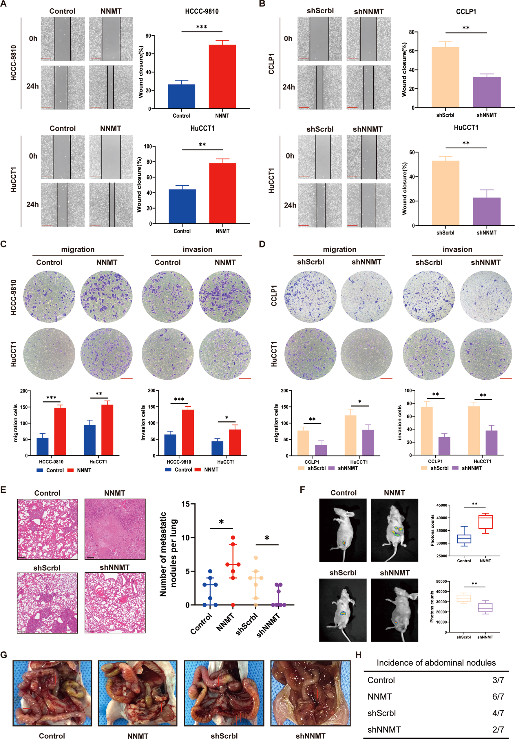 Fig. 3: NNMT promotes the migration and invasion of iCCA cells in vitro and in vivo.