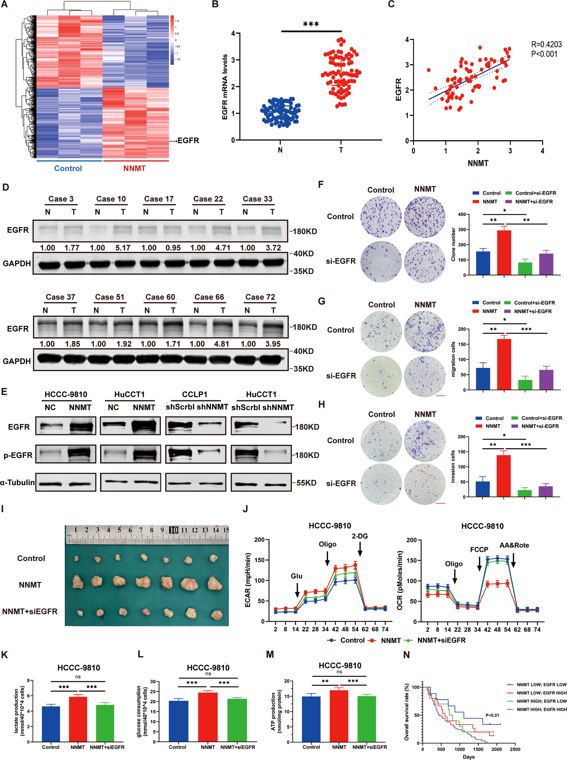 Fig. 5: NNMT regulates EGFR expression and the Warburg effect in iCCA cells.