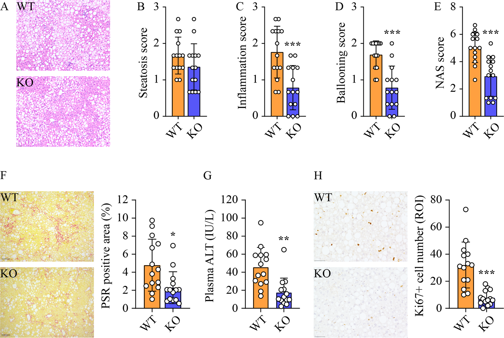Fig. 2: Sphk2-KO mitigates HCC-promoting pathological changes in non-tumorous liver tissues.