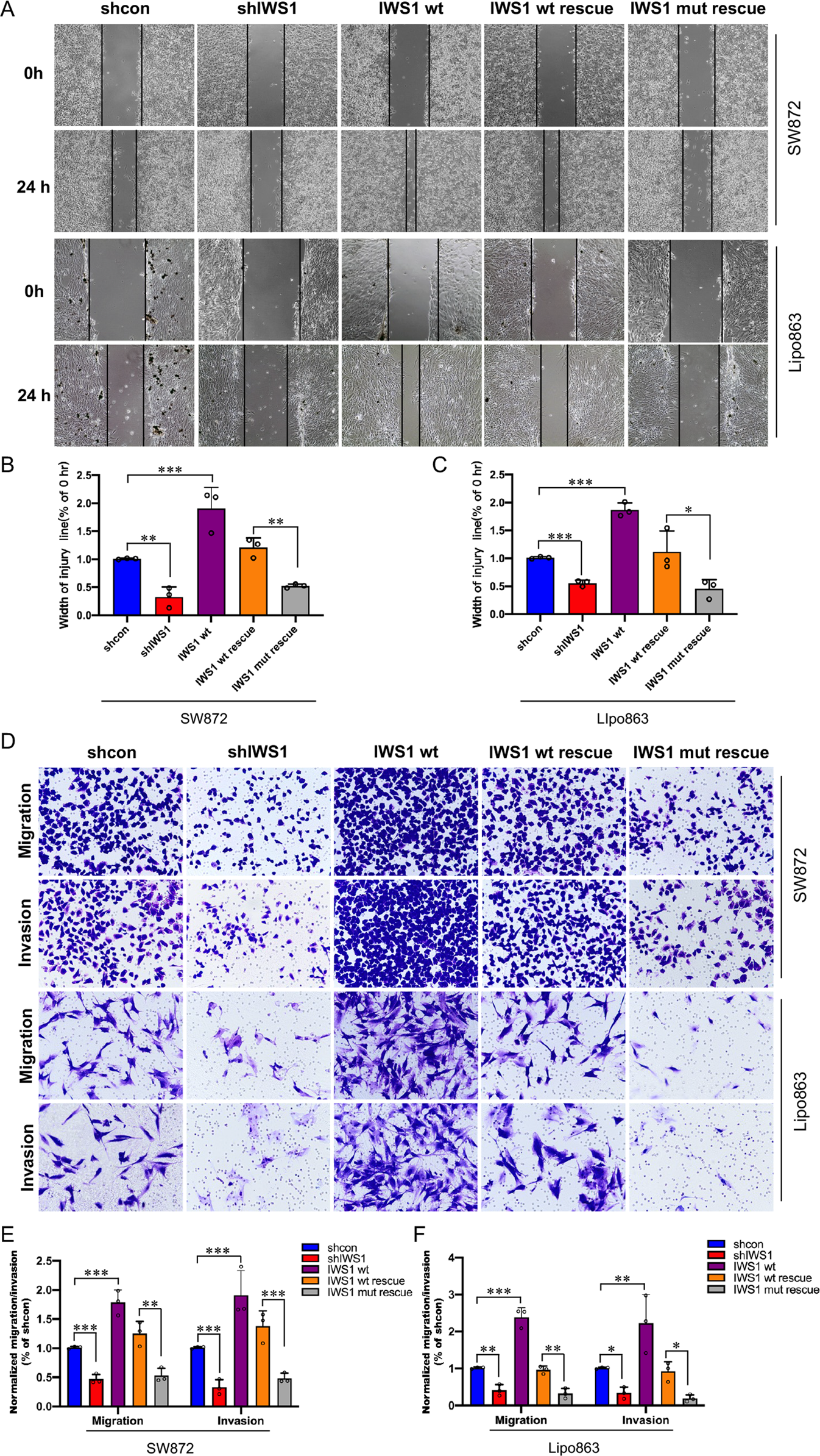 Fig. 4: IWS1 phosphorylation at Ser720/Thr721 promote LPS cell migration and invasion.