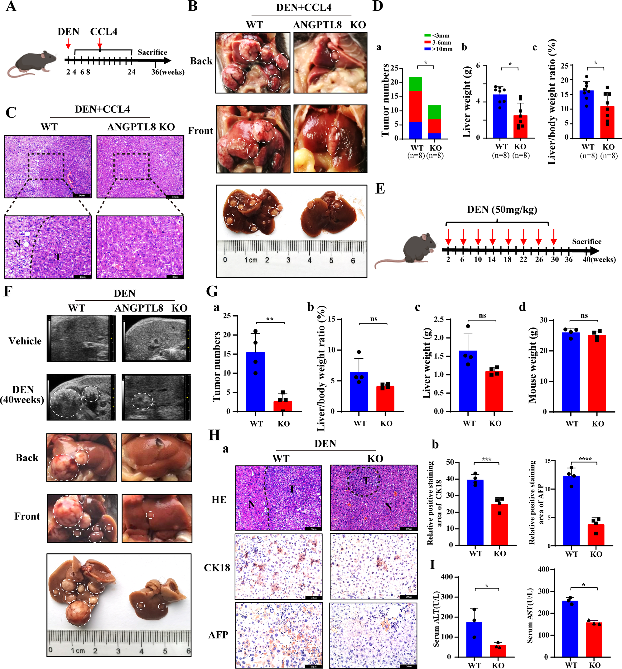 Fig. 1: ANGPTL8 KO alleviates the progression of DEN- and DEN-plus-CCL4-induced HCC.