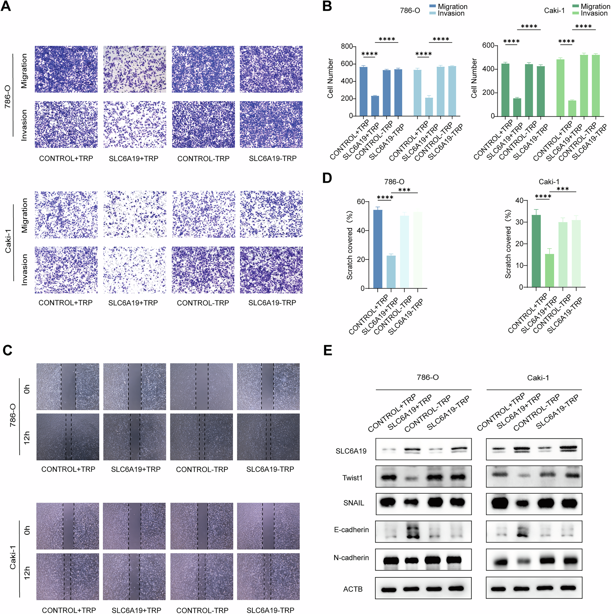 Fig. 3: SLC6A19 inhibits RCC metastasis via transporting tryptophan.