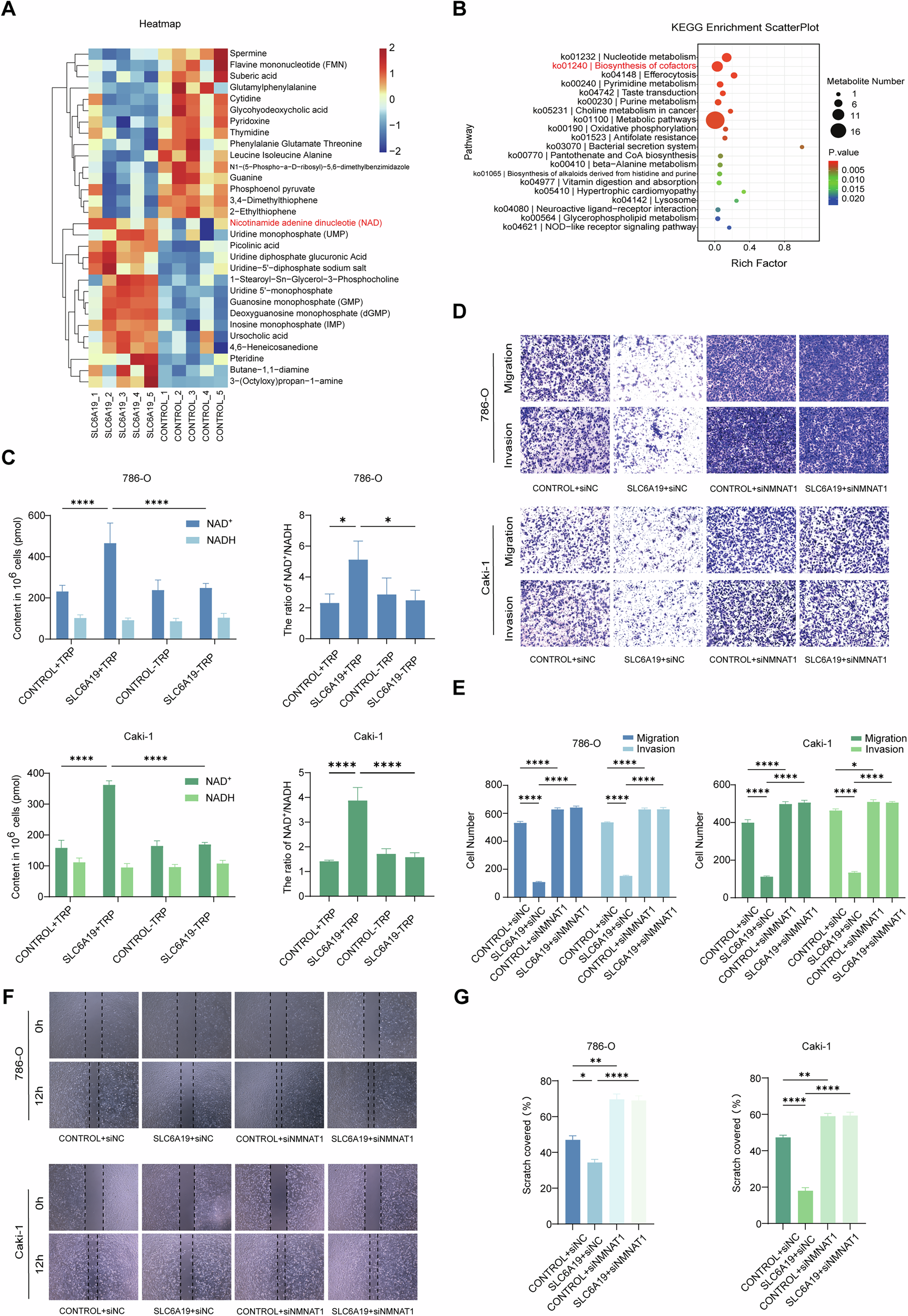 Fig. 4: SLC6A19 inhibits RCC metastasis by mediating de novo NAD+ biosynthesis.