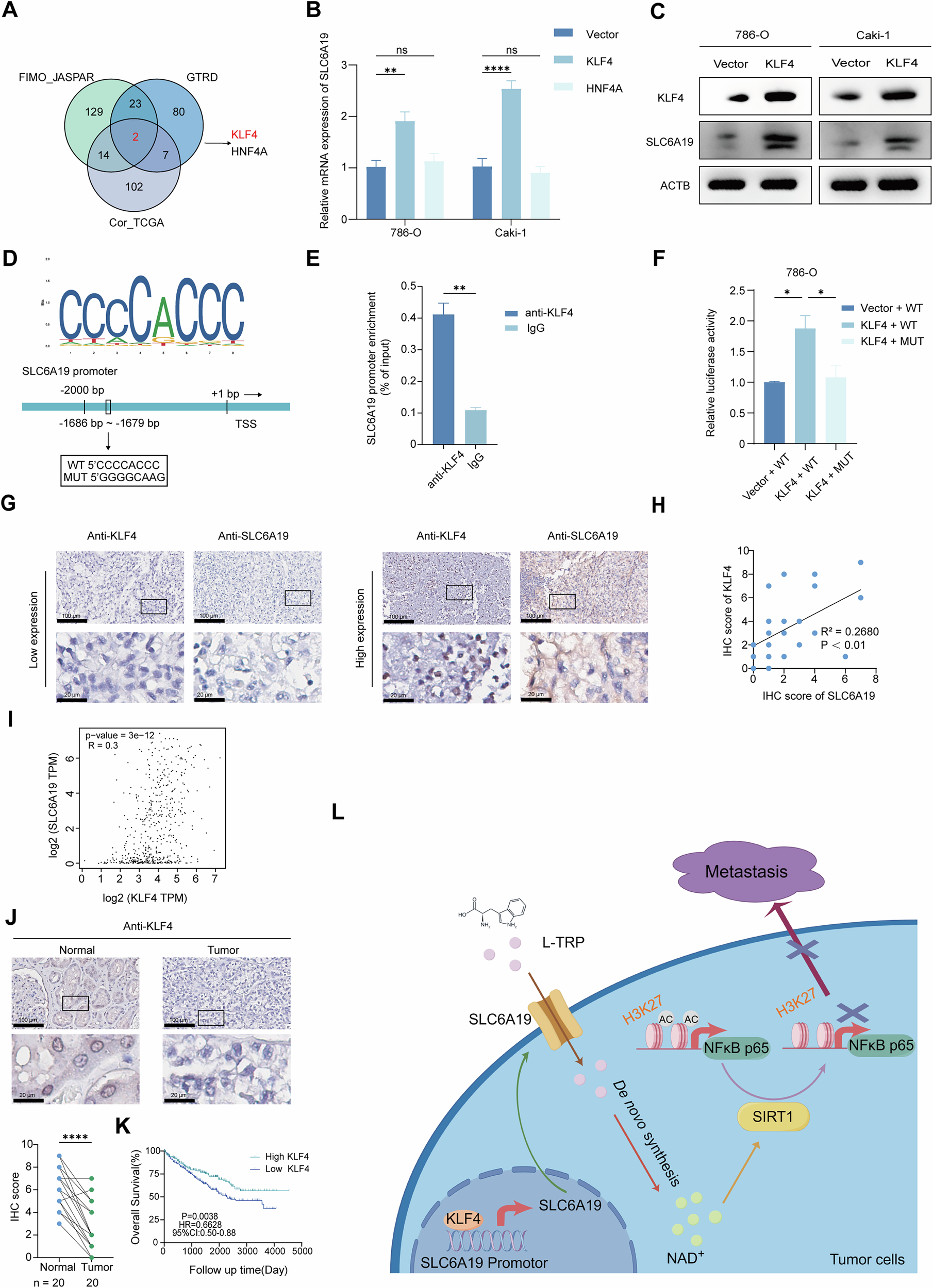 Fig. 6: KLF4 inactivation mediates the low expression of SLC6A19 in RCC.