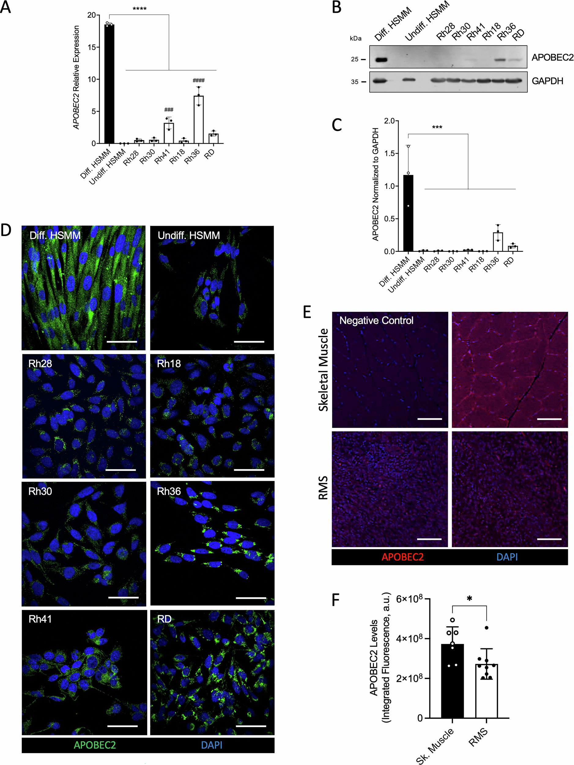 Fig. 1: Endogenous expression of APOBEC2 in patient-derived RMS cell lines and tumor specimens.