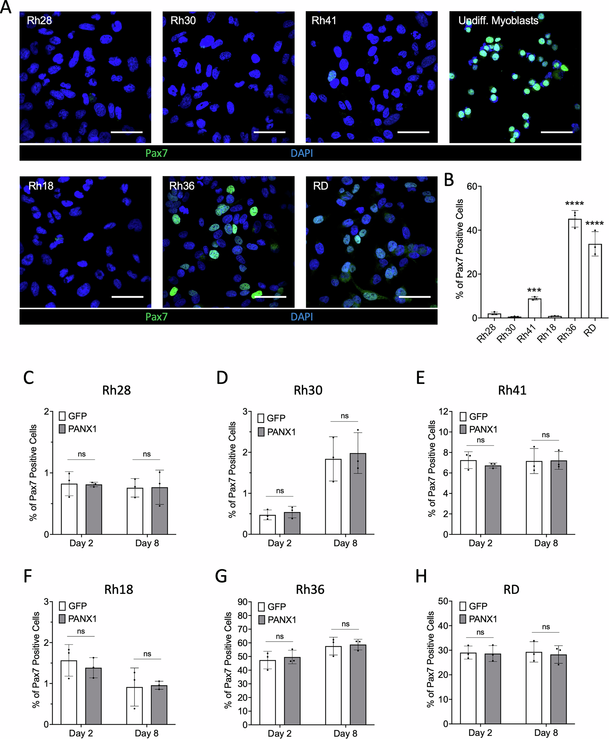 Fig. 3: Pax7 expression in wild-type RMS cell lines and following PANX1 overexpression.