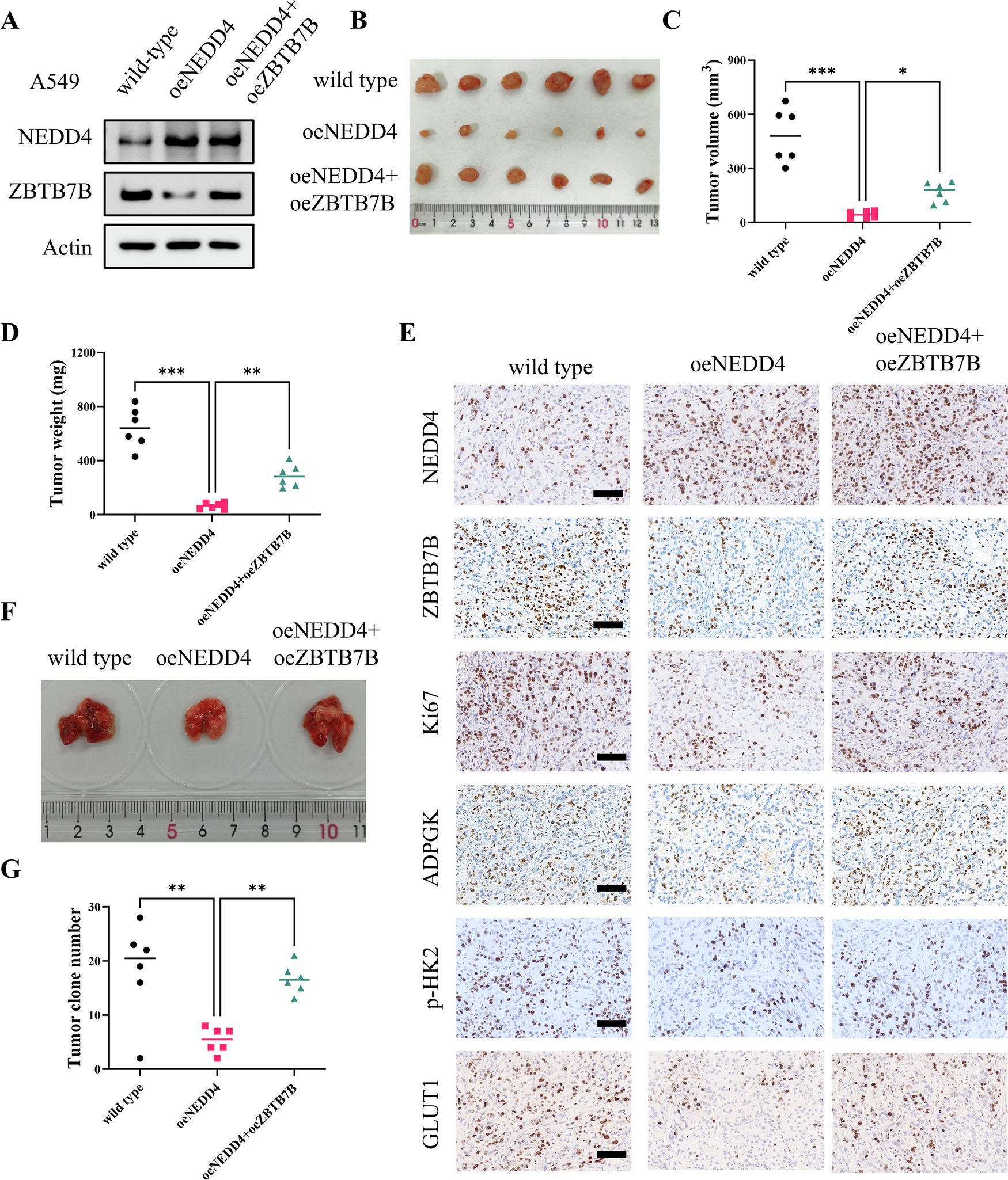 Fig. 8: NEDD4-mediated ZBTB7B degradation suppresses LUAD progression in vivo.