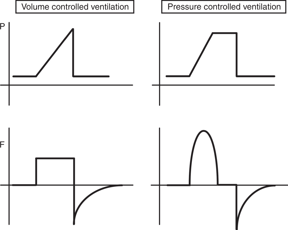 Modes and strategies for providing conventional mechanical ventilation in  neonates | Pediatric Research