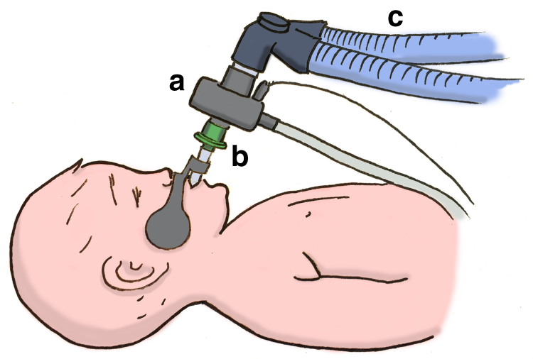 Anatomic and physiologic dead space: Video & Anatomy