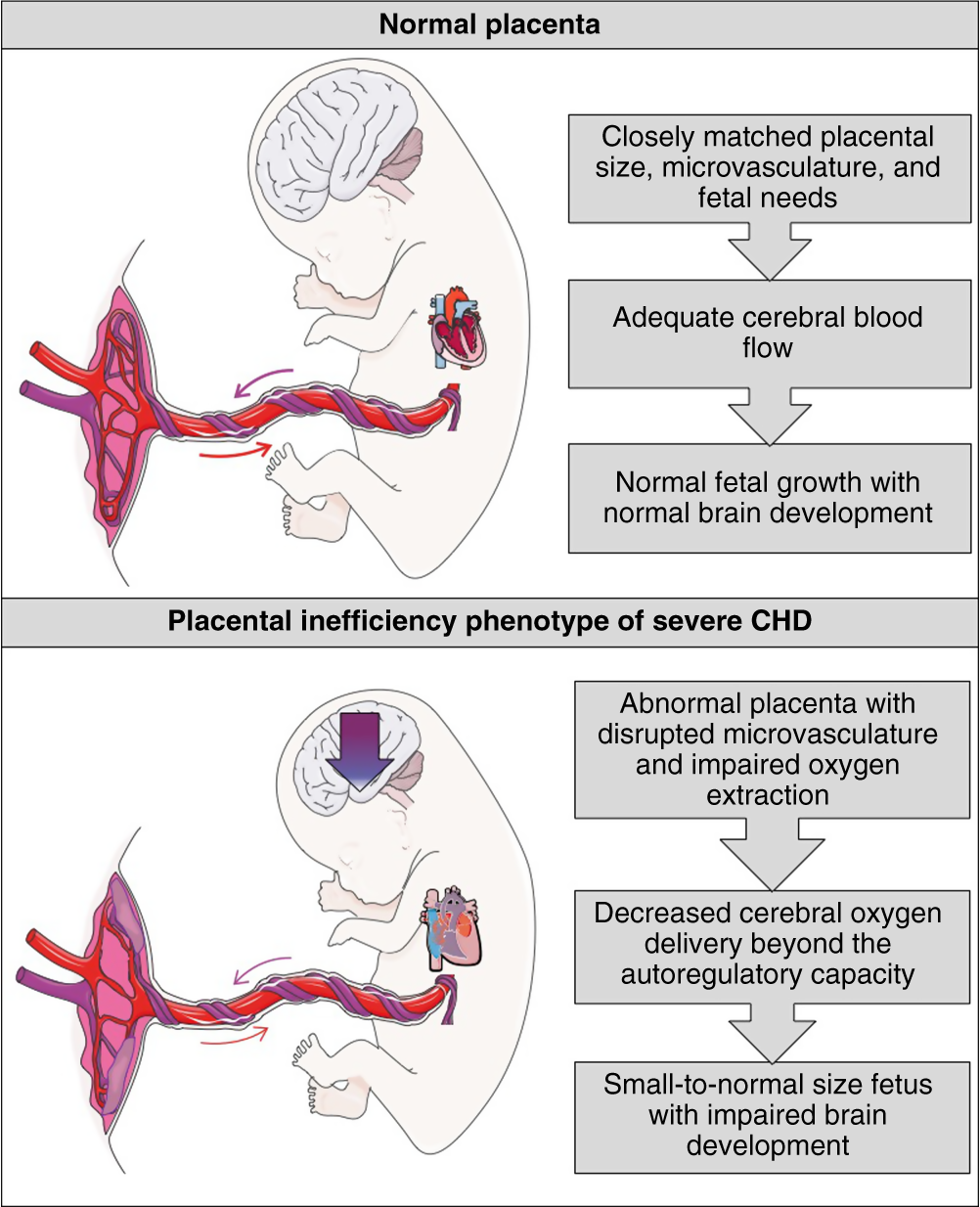 Neuroplacentology in congenital heart disease: placental connections to  neurodevelopmental outcomes | Pediatric Research, image size:1002x1234