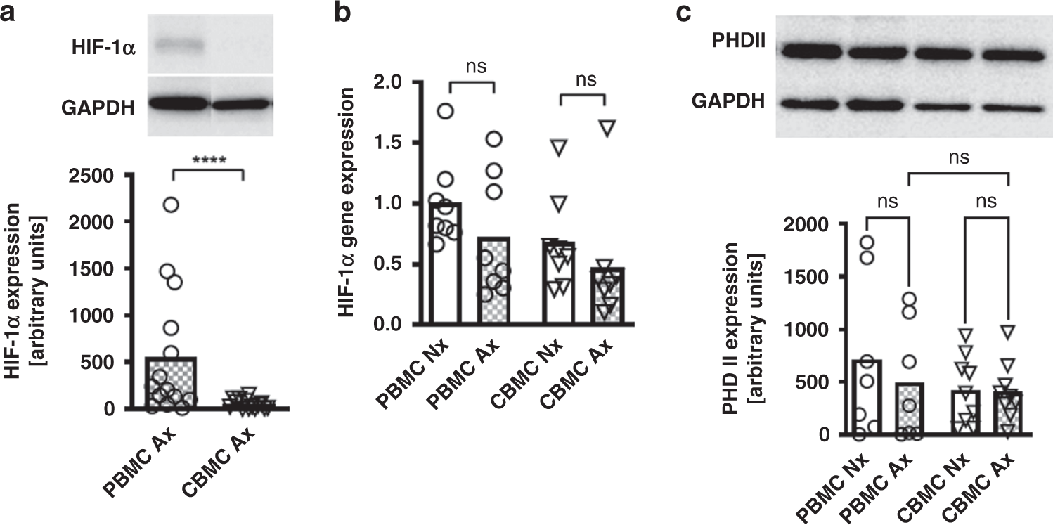 Fig. 1: HIF-1α expression in cord blood and adult mononuclear cells under anoxia.