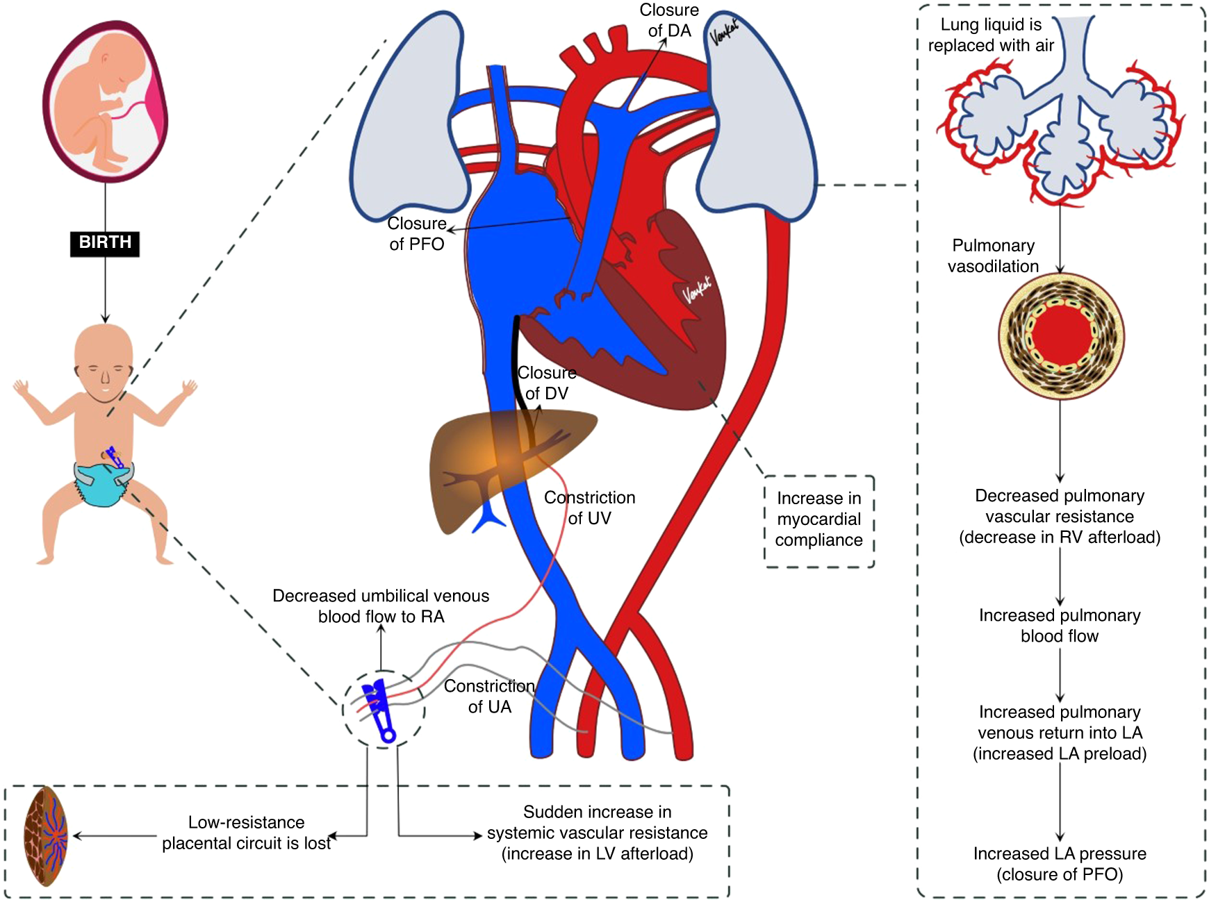 Transitional circulation and hemodynamic monitoring in newborn infants |  Pediatric Research