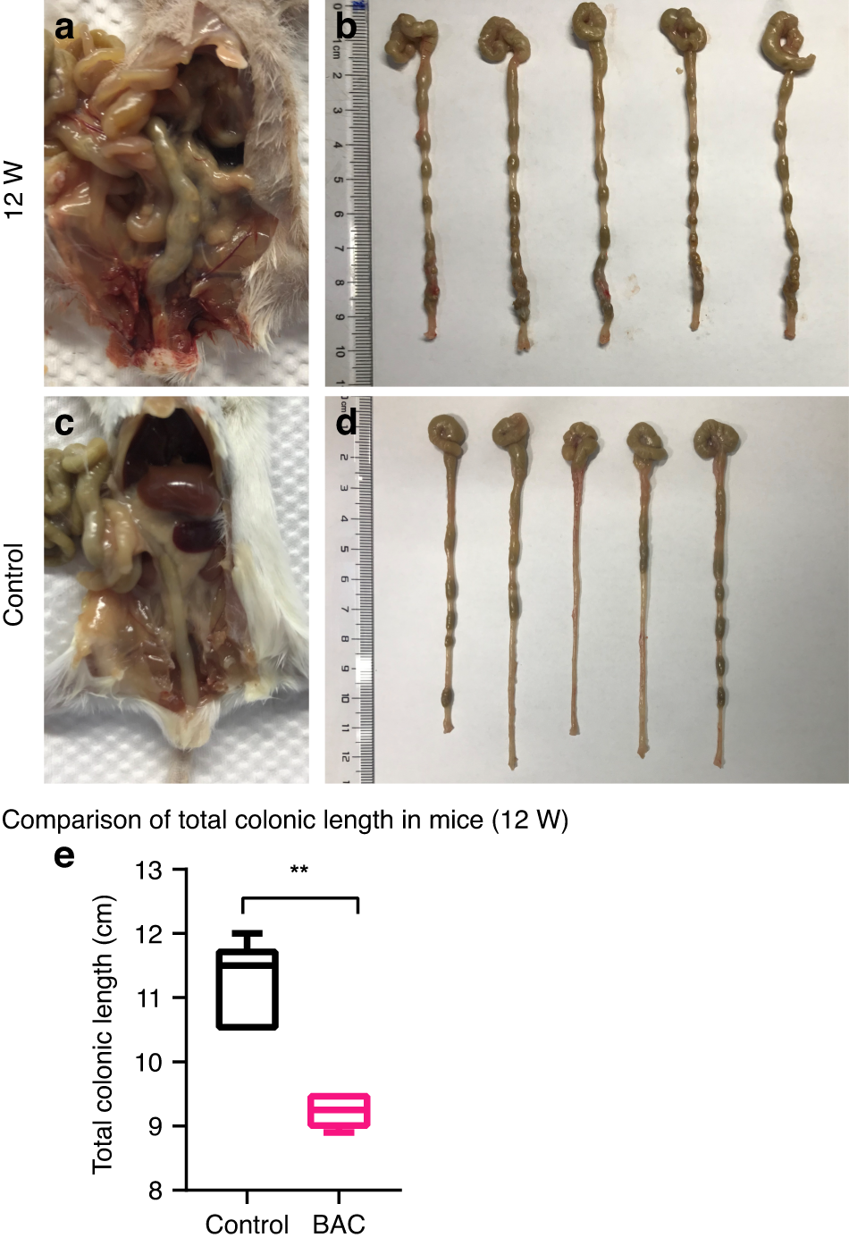 Fig. 4: Gross morphological observation of colon tissue in the treatment group and control group at 12 weeks after BAC treatment.