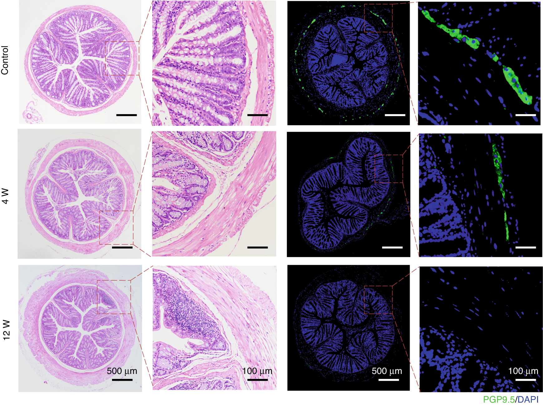 Fig. 5: H&E and IF staining of colon tissue in the control group and narrow segment tissue in the treatment group.