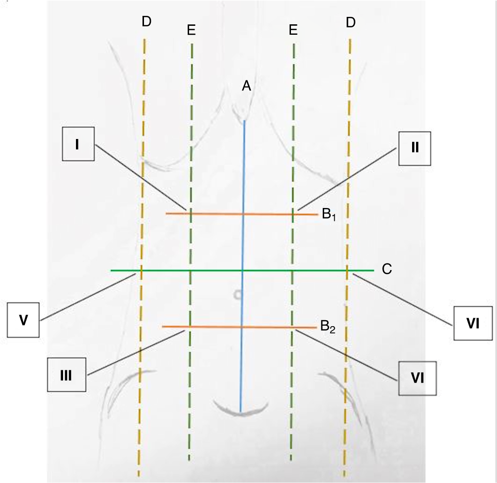 Fig. 1: Ultrasound of the abdominal wall. Schematic drawing of the positions Q6for sonography.