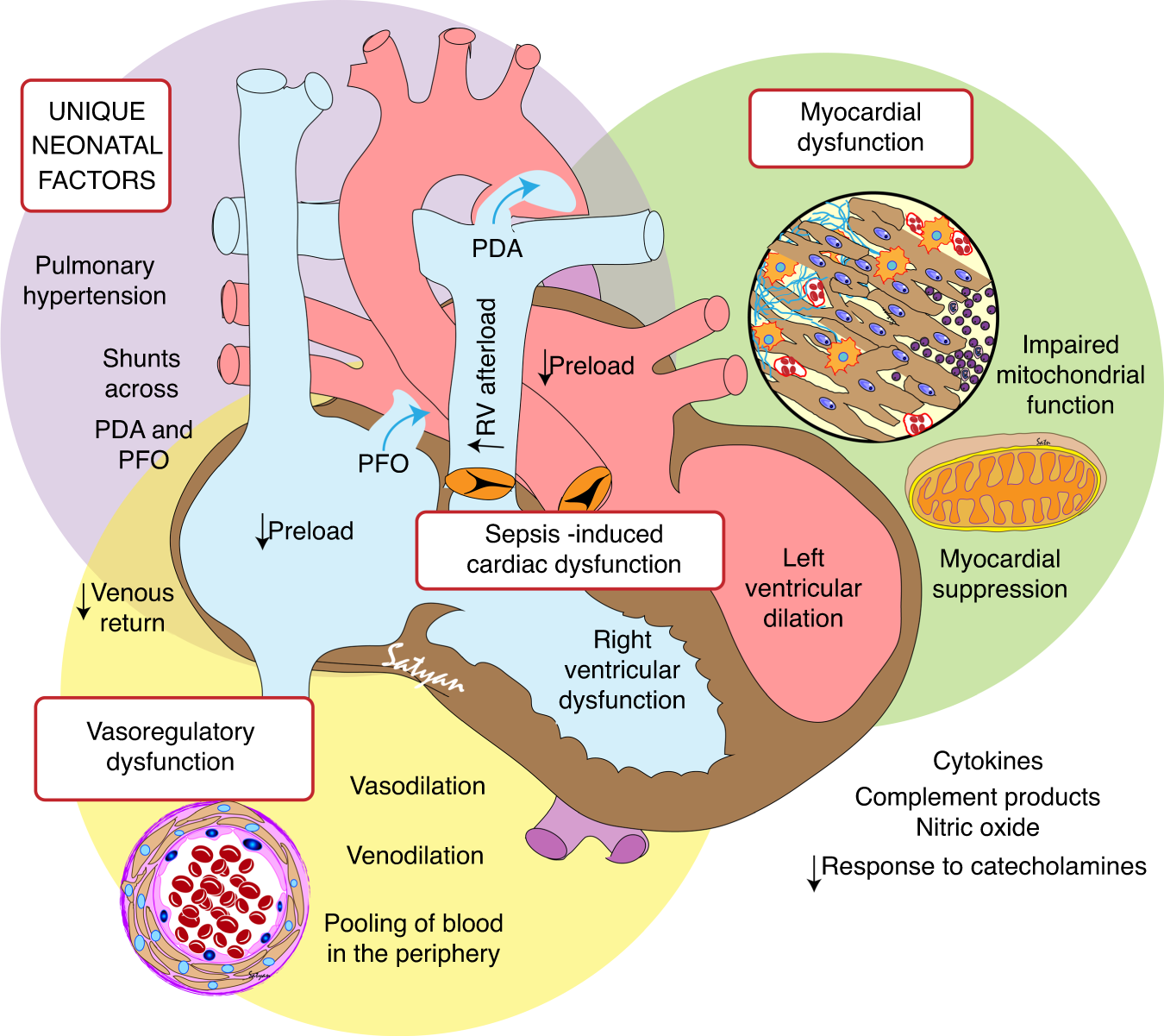 Neonatal sepsis and cardiovascular dysfunction I: mechanisms and 