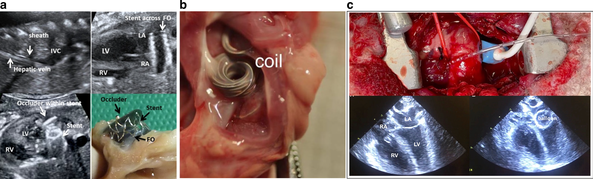 Fig. 4: Three methods to induce hypoplastic left heart syndrome in a fetal lamb model.