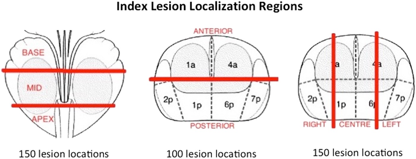 68ga Psma Pet Ct Vs Mpmri For Locoregional Prostate Cancer Staging Correlation With Final Histopathology Prostate Cancer And Prostatic Diseases