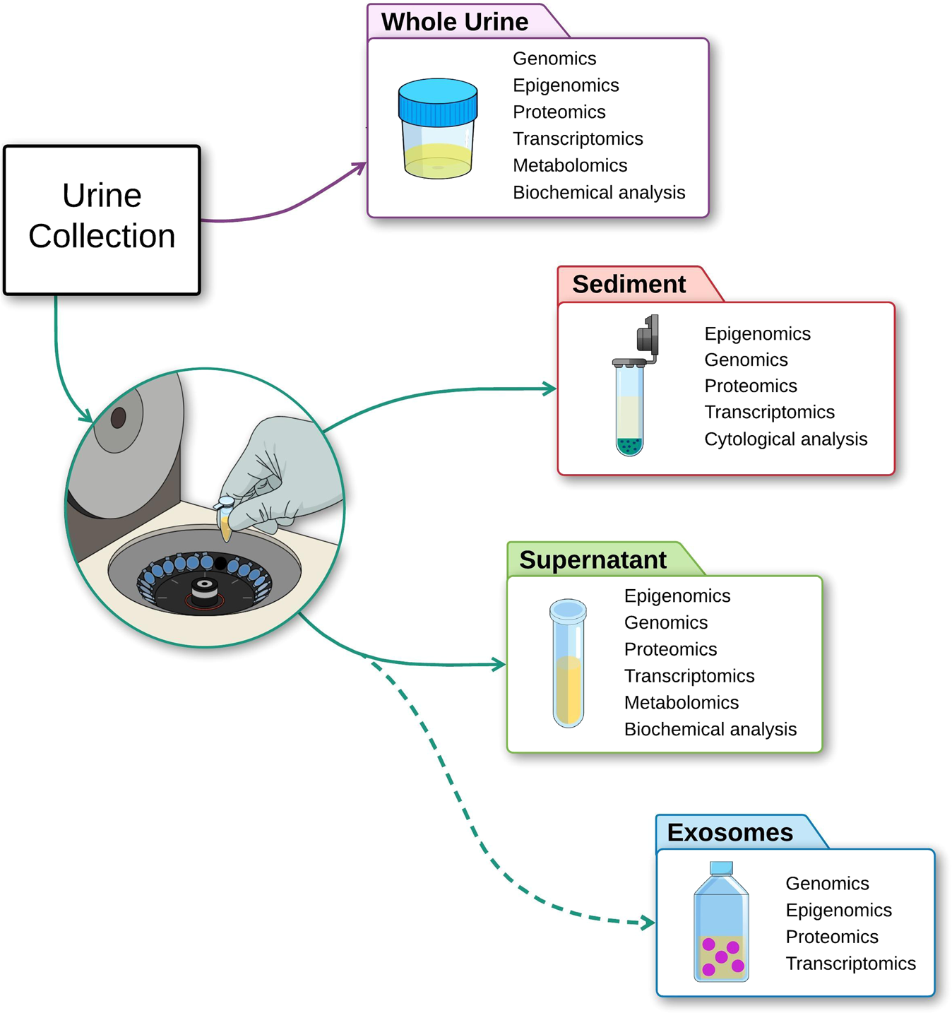 exosome urine test for prostate cancer