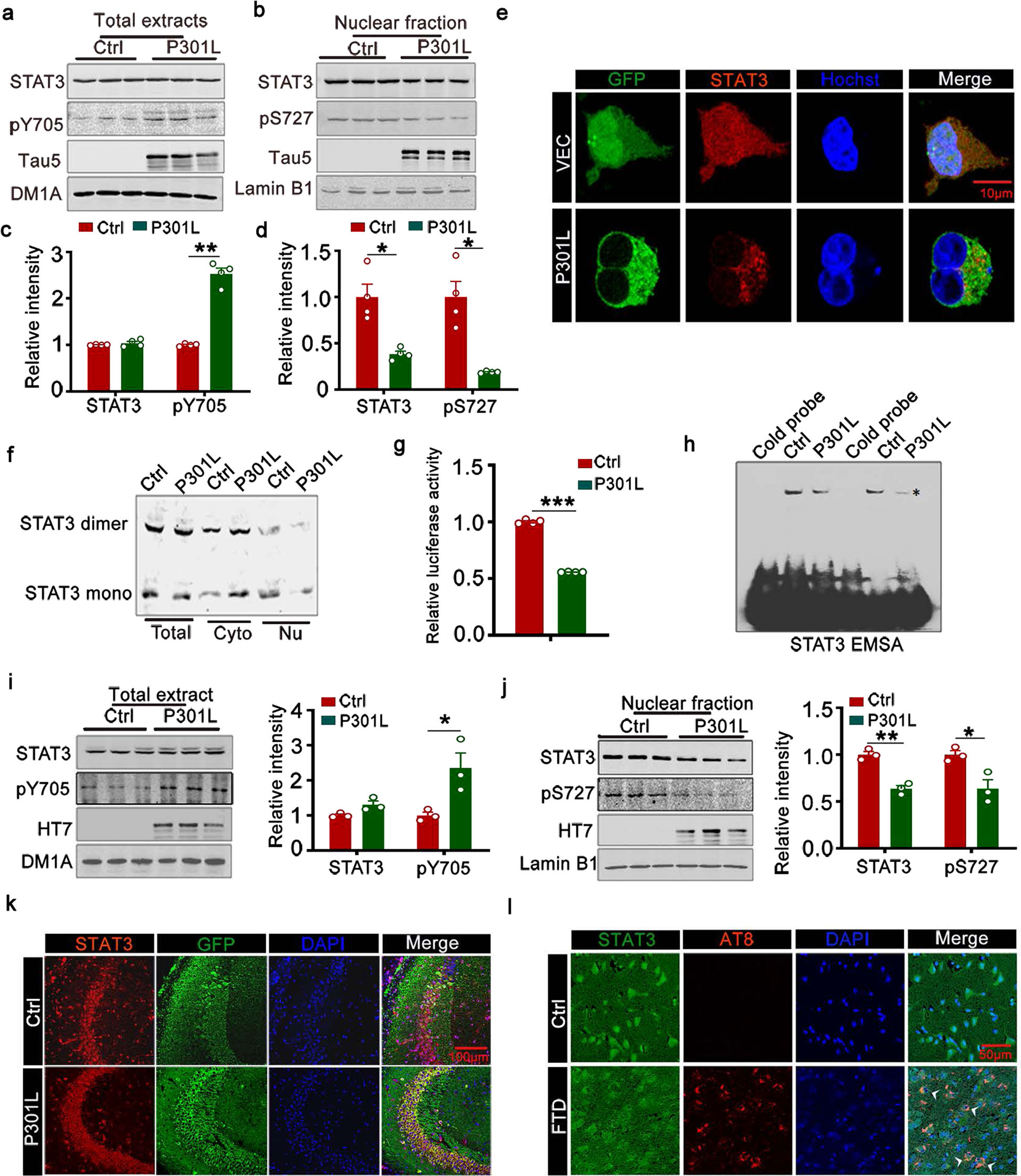 STAT3 ameliorates cognitive deficits by positively regulating the  expression of NMDARs in a mouse model of FTDP-17 | Signal Transduction and  Targeted Therapy