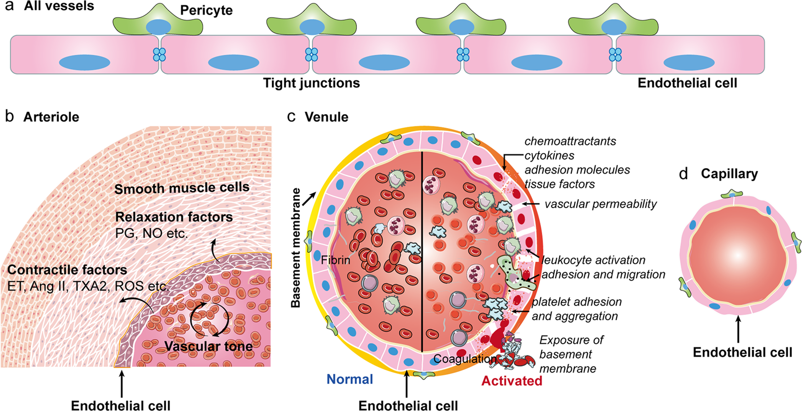 Endothelial cell infection and endotheliitis in COVID-19 - The Lancet