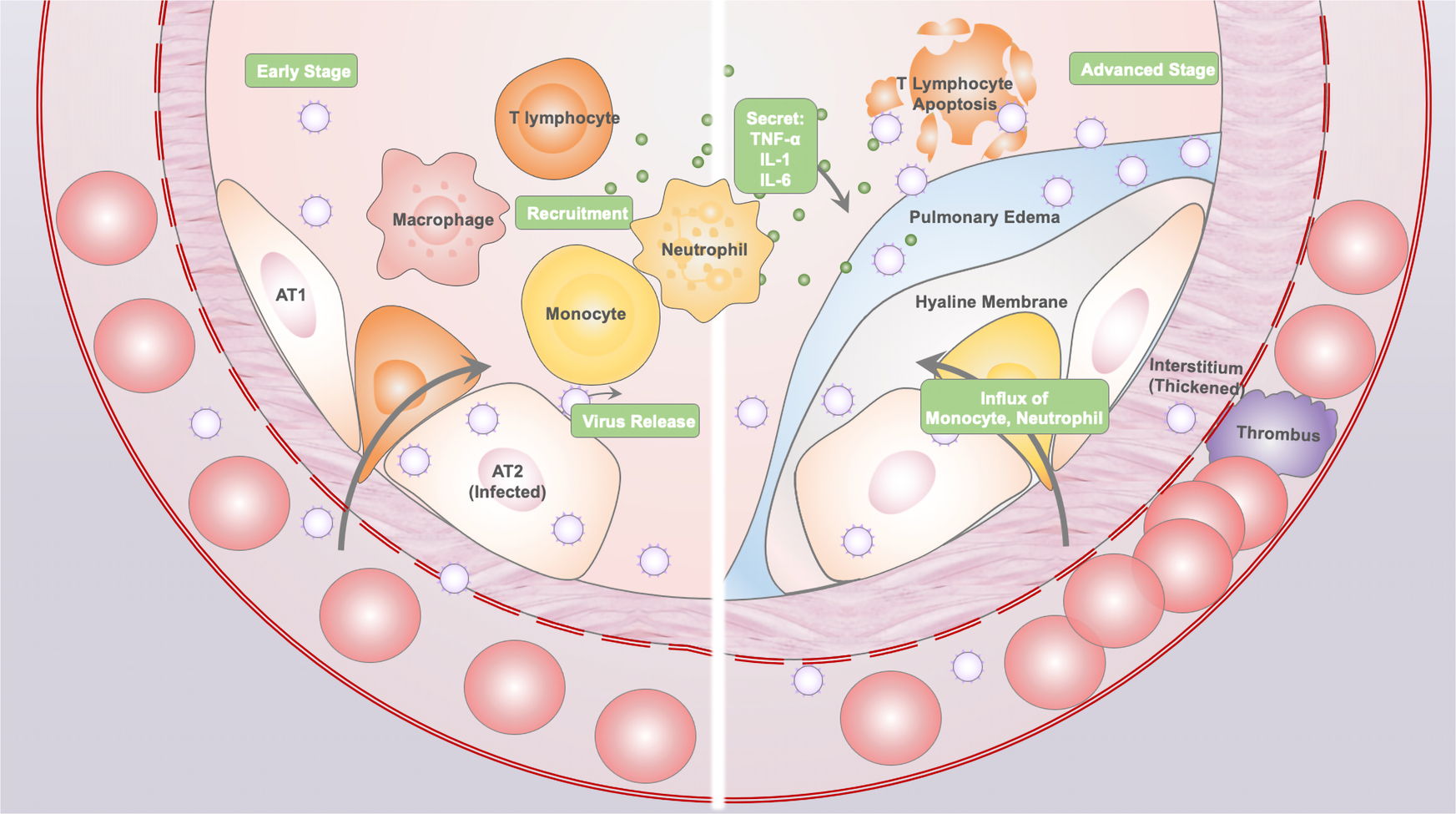 Feature  Returning to Play After Coronavirus Infection: A Perspective From  Pediatric Cardiologists - American College of Cardiology