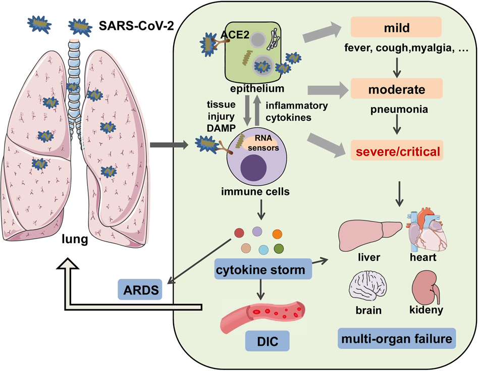 Understanding SARS-CoV-2-Mediated Inflammatory Responses: From Mechanisms  to Potential Therapeutic Tools