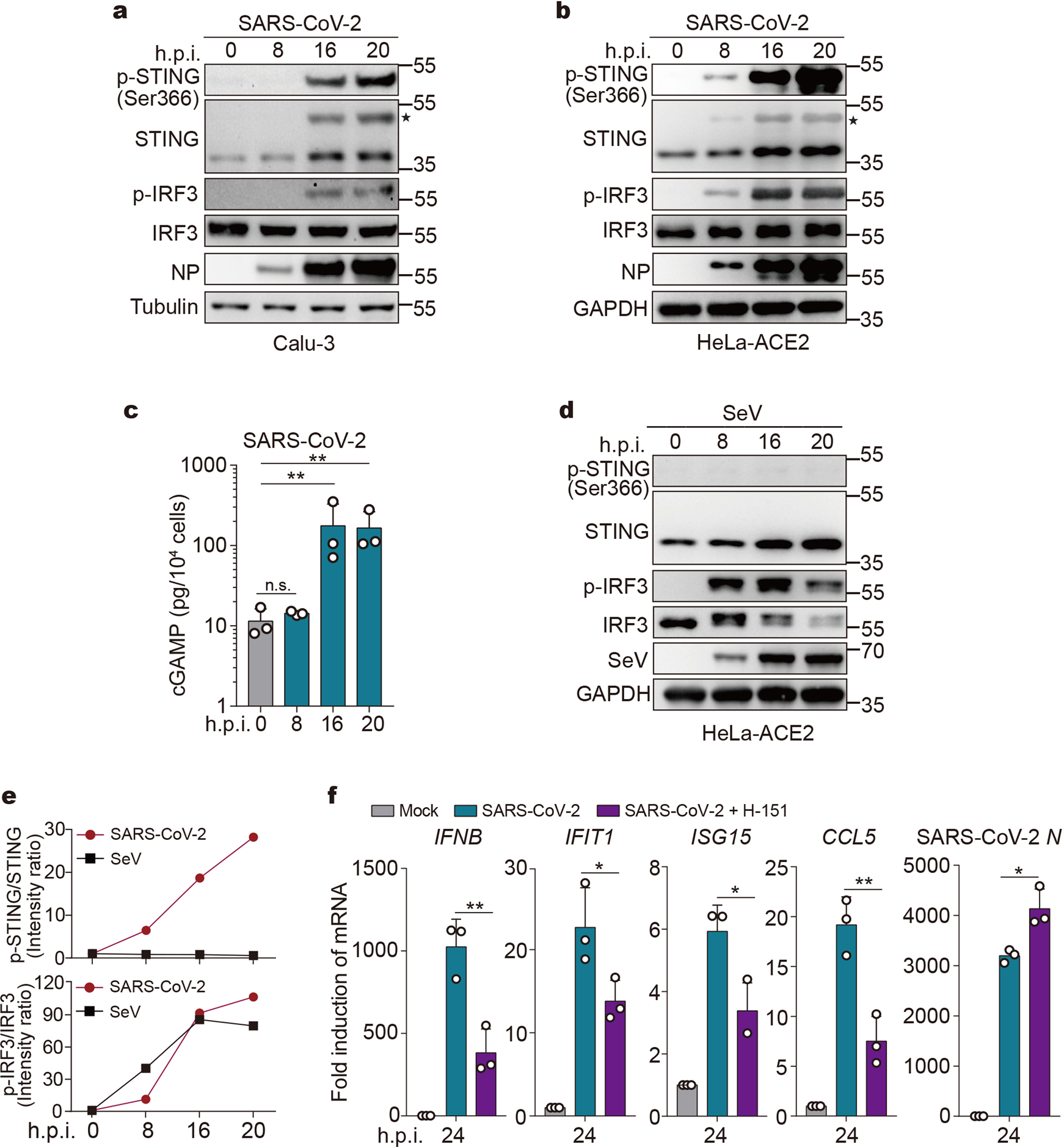 Sensing of cytoplasmic chromatin by cGAS activates innate immune response  in SARS-CoV-2 infection | Signal Transduction and Targeted Therapy
