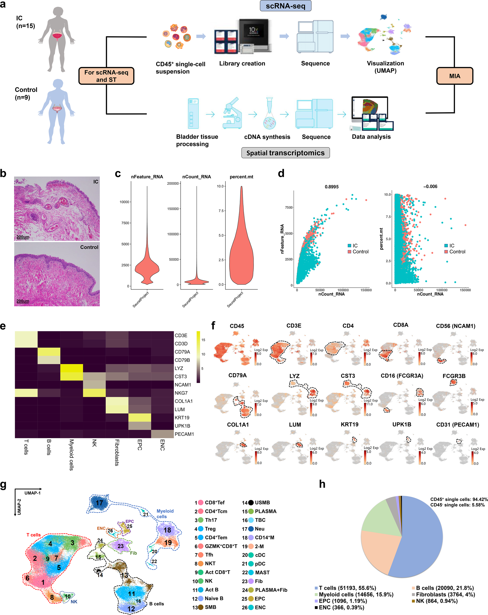 Integrating single-cell RNA sequencing with spatial transcriptomics reveals  immune landscape for interstitial cystitis | Signal Transduction and  Targeted Therapy