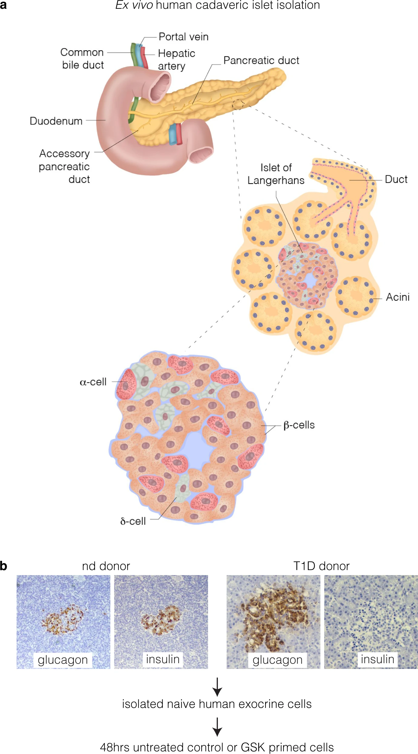 Potential Target for Type 1 Diabetes Treatment