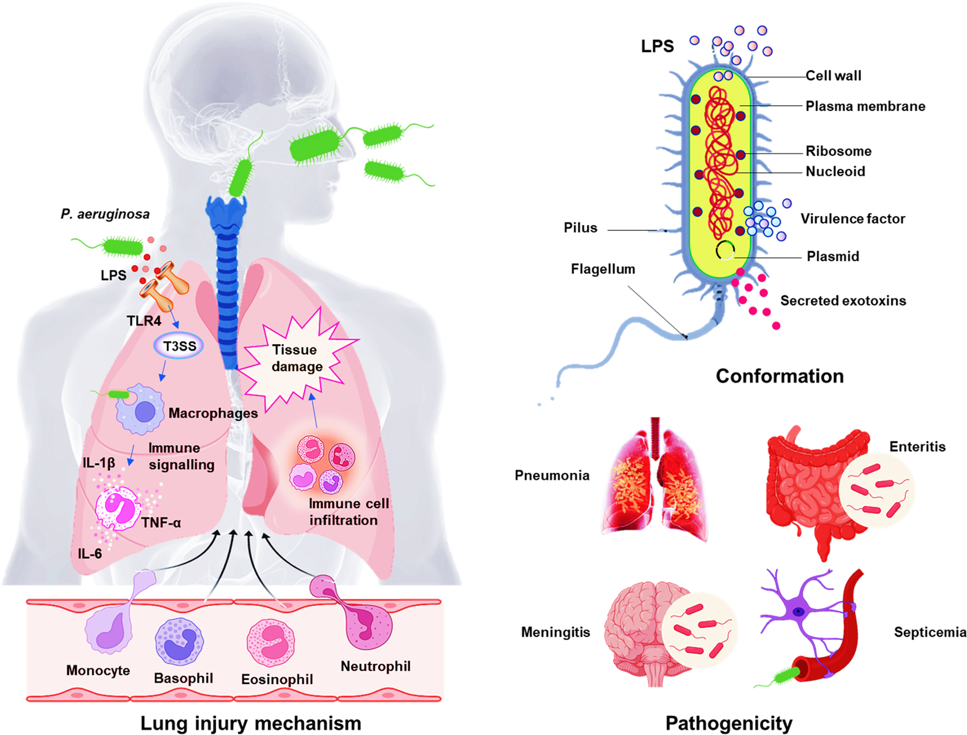 Pseudomonas aeruginosa: pathogenesis, virulence factors, antibiotic  resistance, interaction with host, technology advances and emerging  therapeutics | Signal Transduction and Targeted Therapy